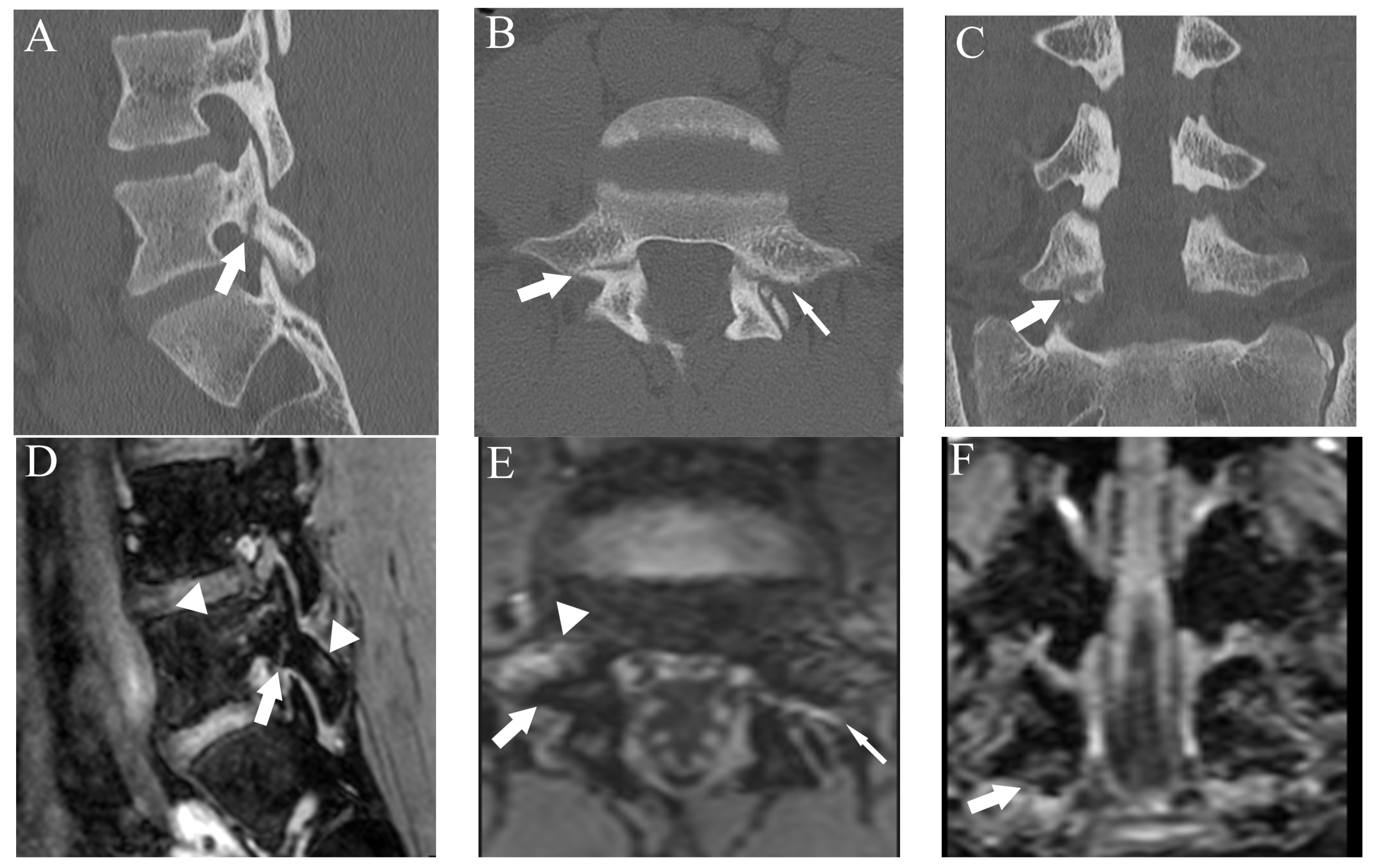 Diagnostics 13 00461 g006 Diagnostics 13 00461 g006