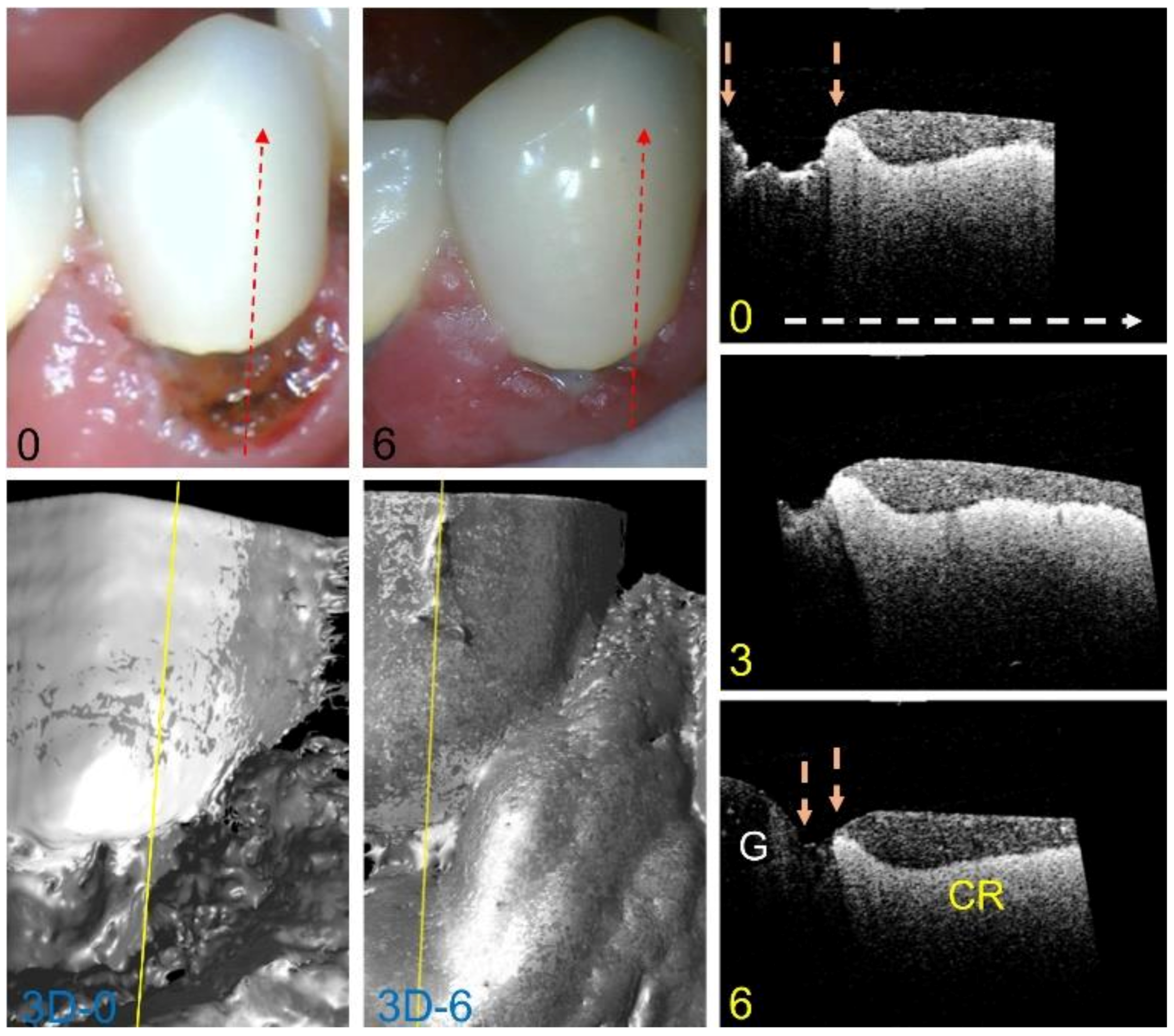 Diagnostics 13 00465 g005