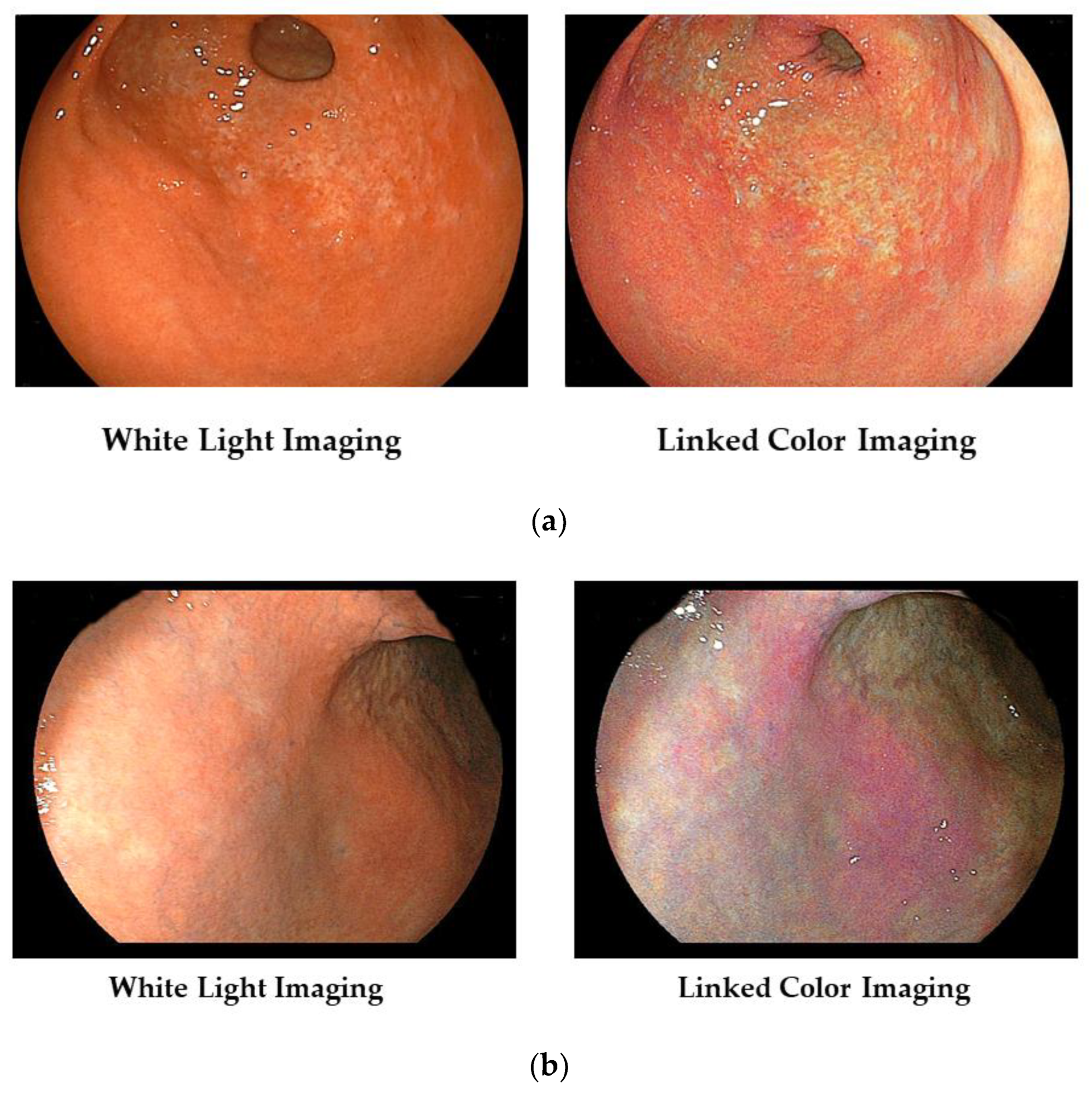 Diagnostics 13 00467 g002 Diagnostics 13 00467 g002