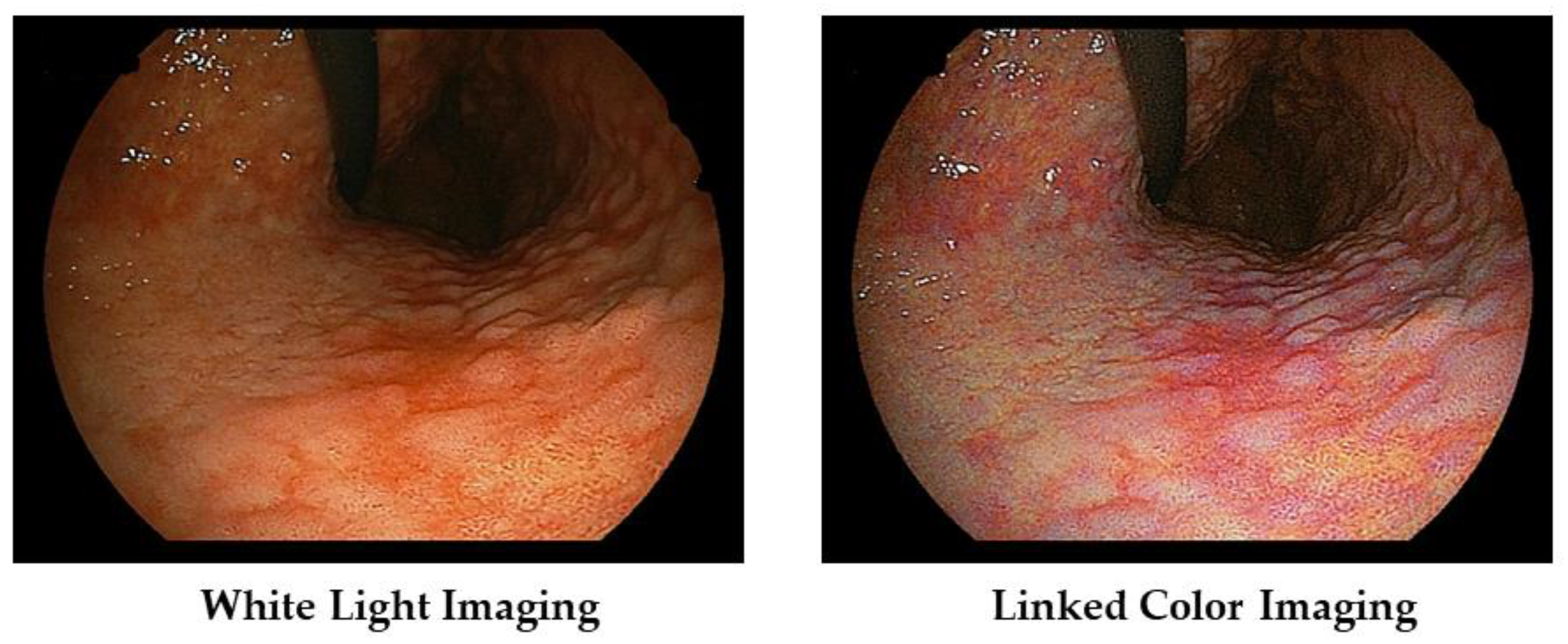 Diagnostics 13 00467 g004 Diagnostics 13 00467 g004