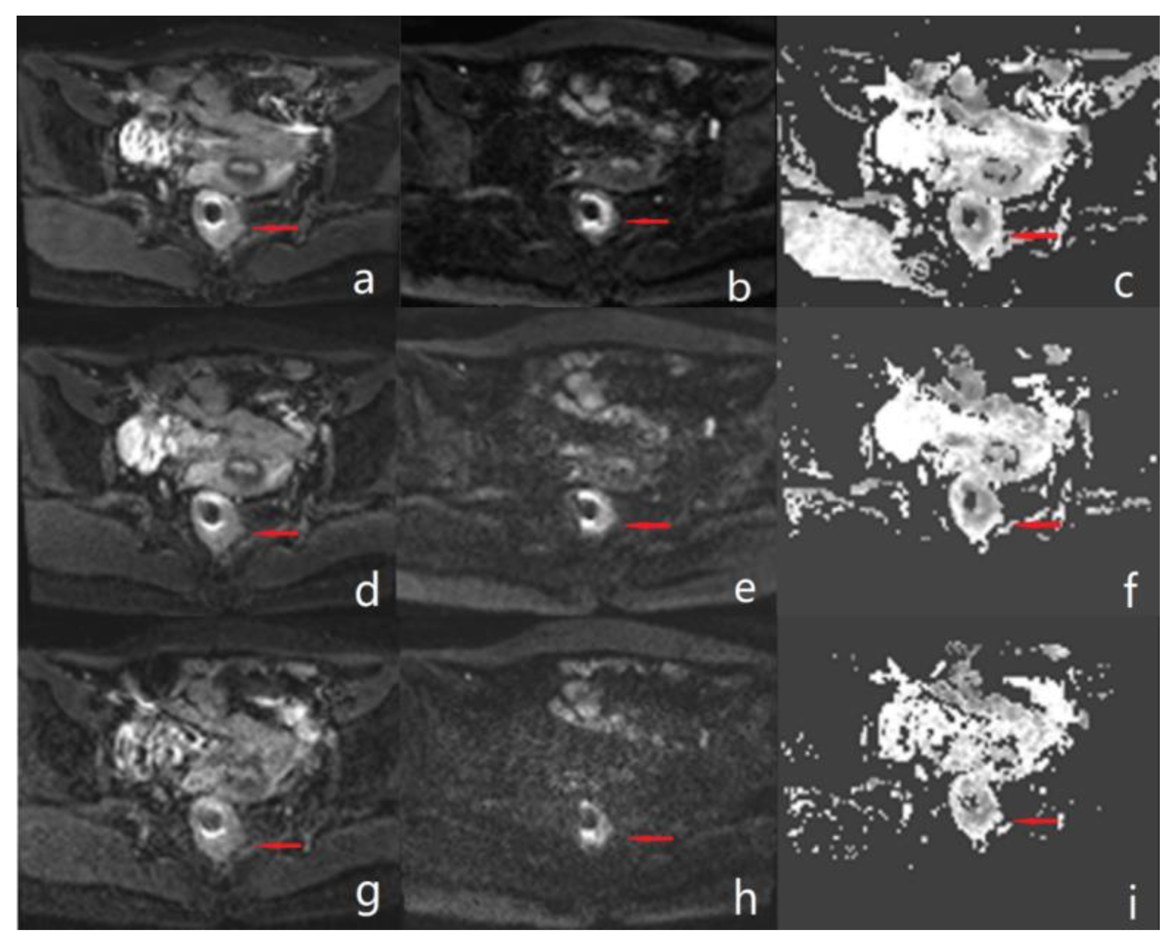 Diagnostics 13 00474 g003 Diagnostics 13 00474 g003