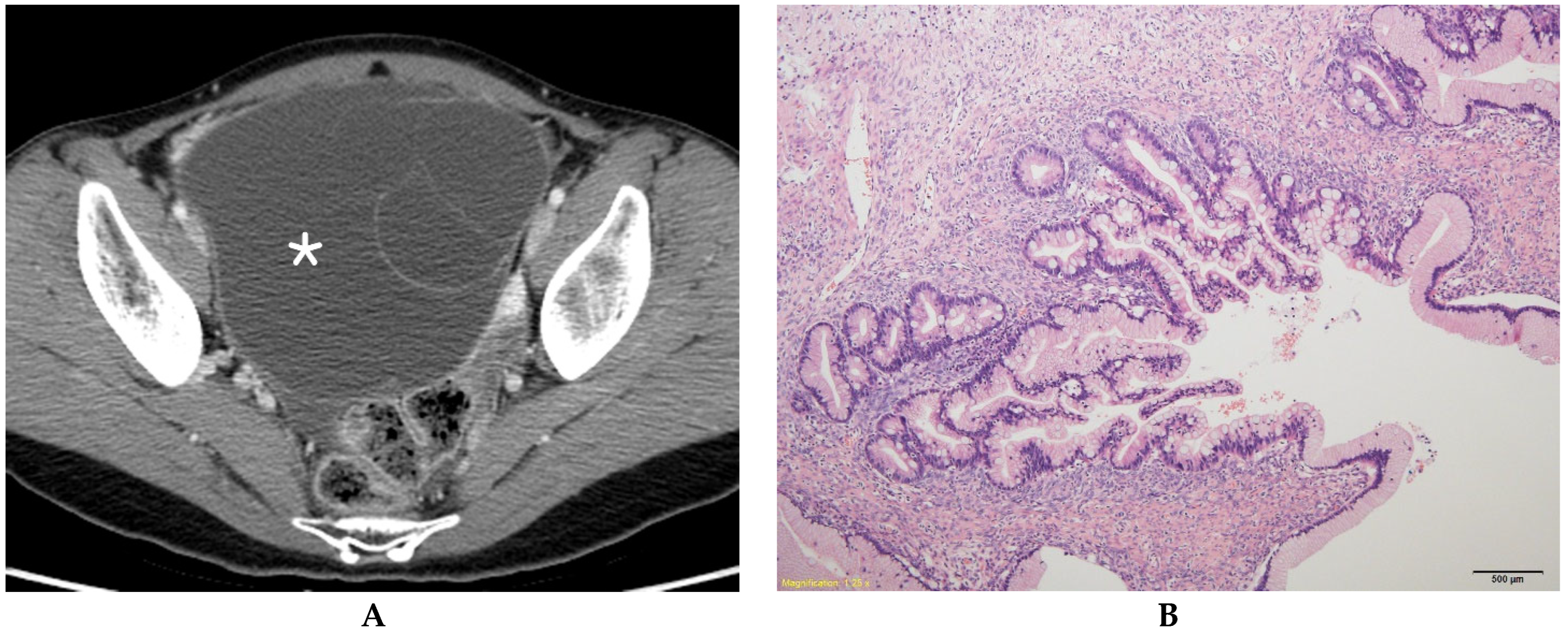 Diagnostics 13 00480 g001 Diagnostics 13 00480 g001