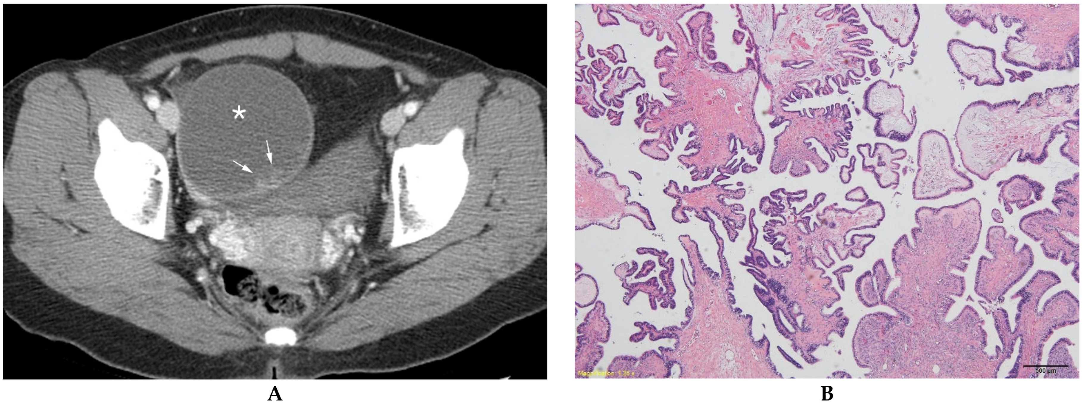Diagnostics 13 00480 g002 Diagnostics 13 00480 g002