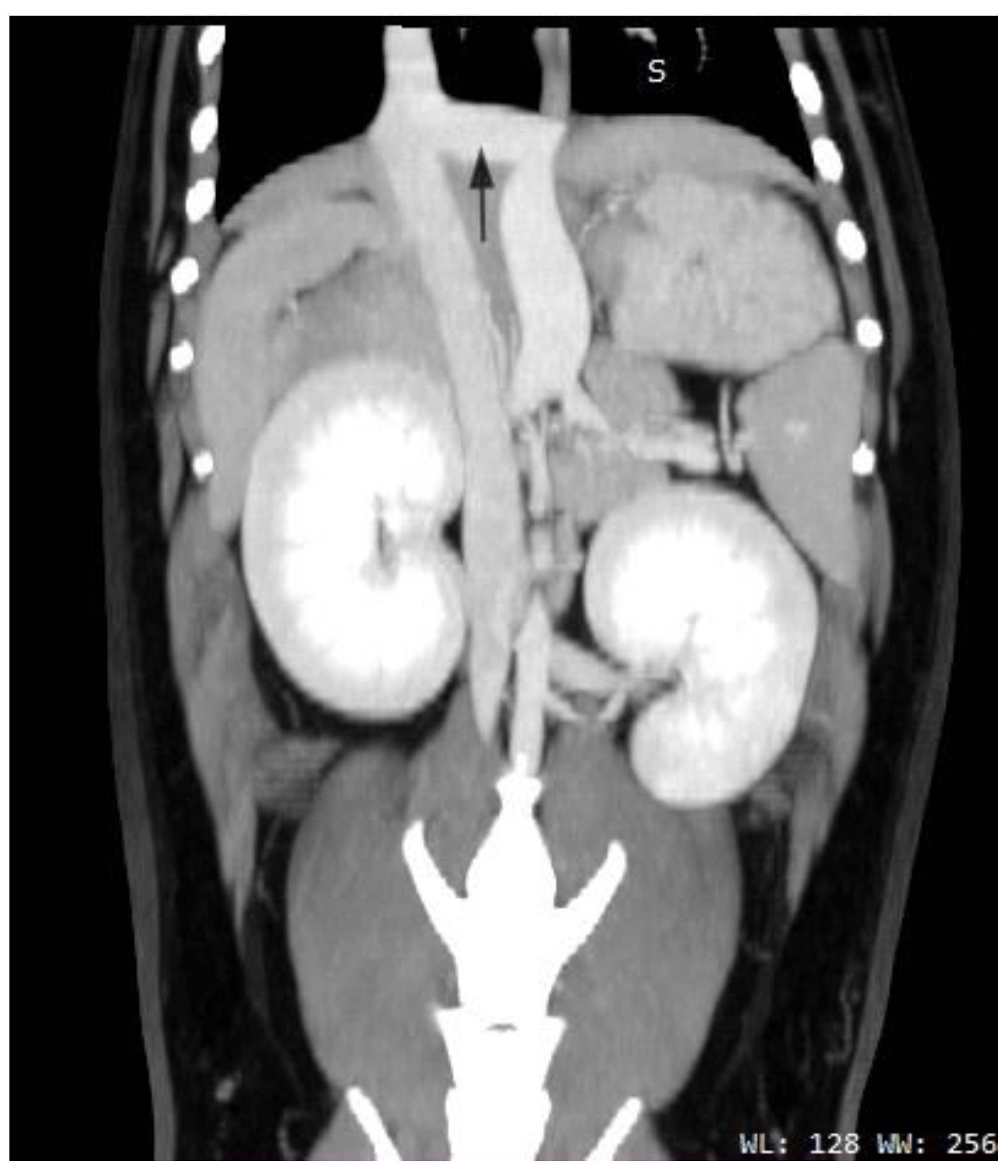 Diagnostics 13 00482 g006