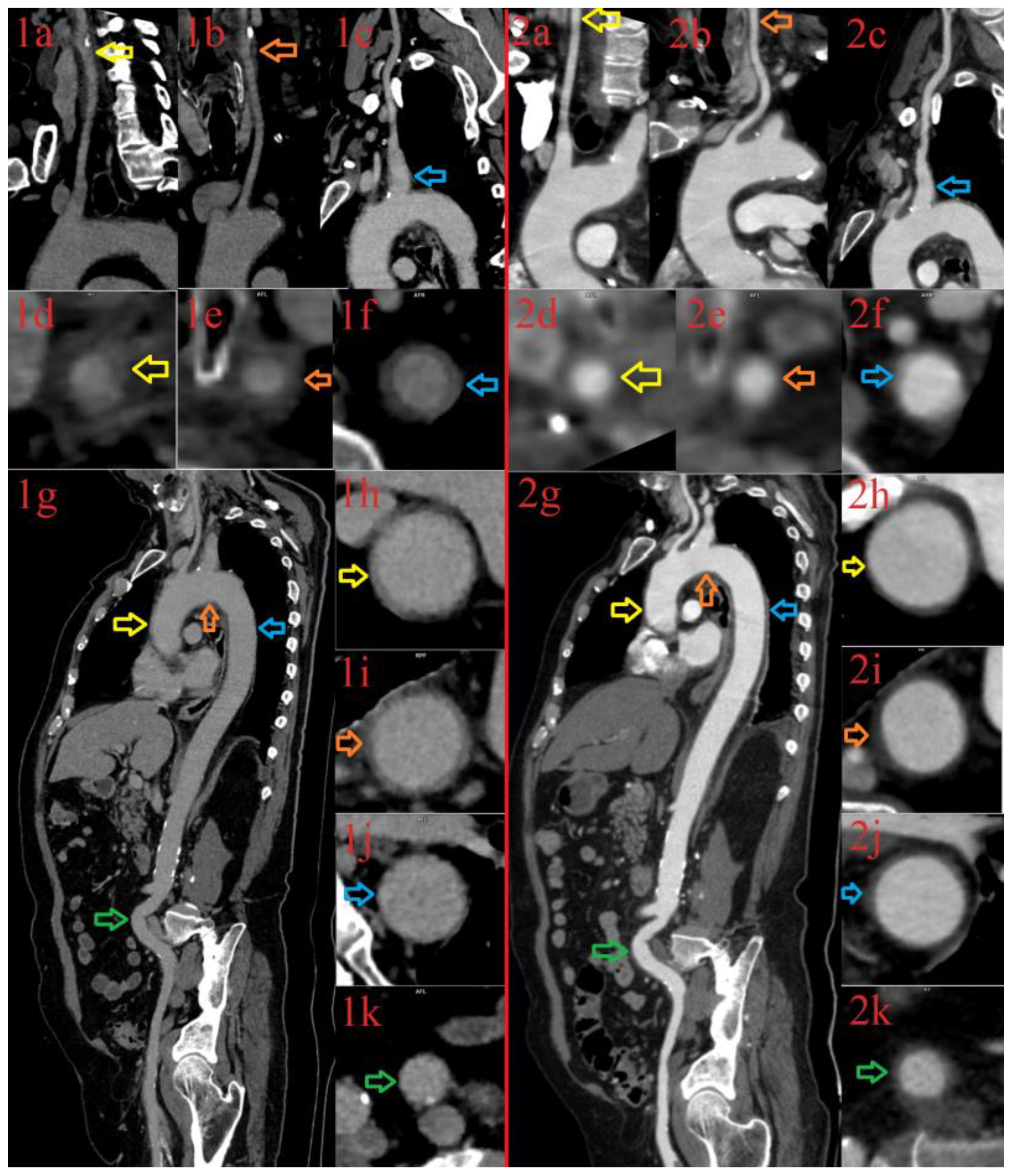 Diagnostics 13 00484 g001 Diagnostics 13 00484 g001