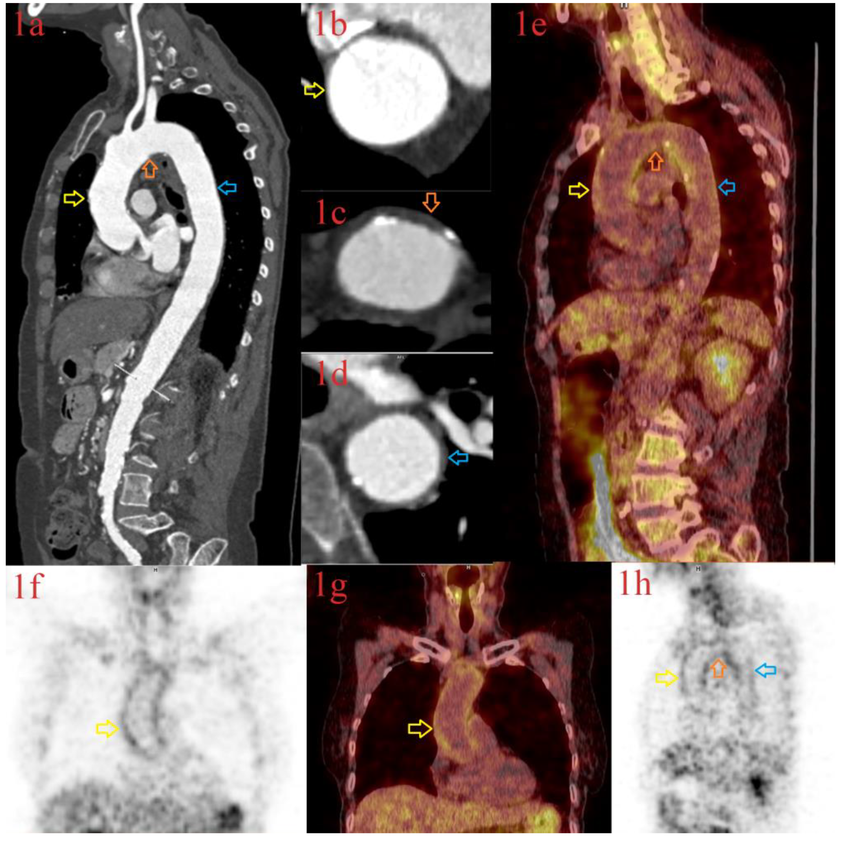 Diagnostics 13 00484 g003 Diagnostics 13 00484 g003