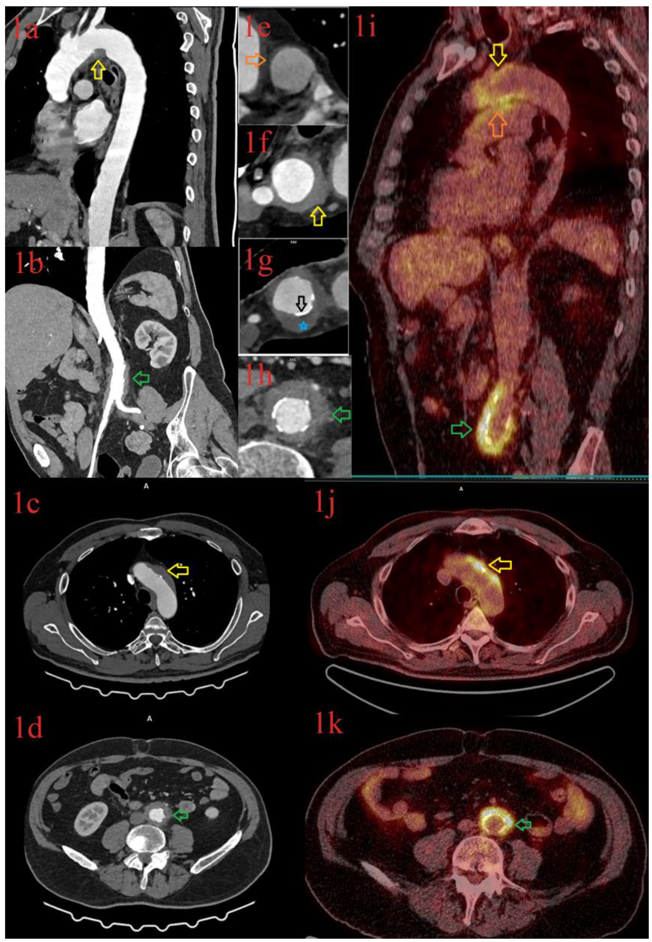 Diagnostics 13 00484 g004 Diagnostics 13 00484 g004