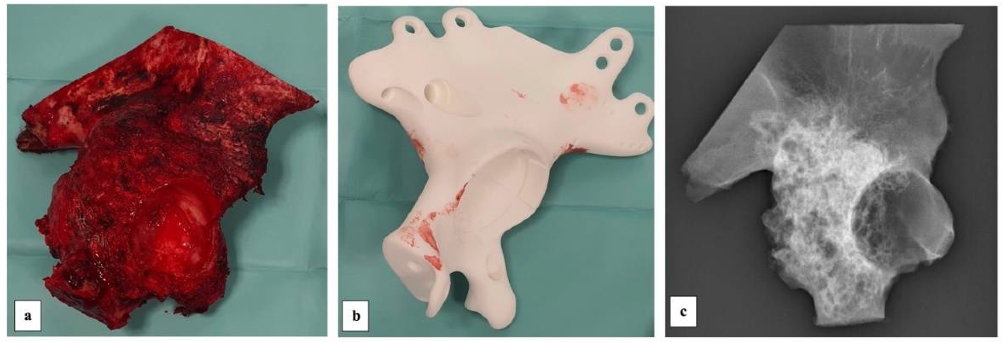 Diagnostics 13 00485 g007 Diagnostics 13 00485 g007