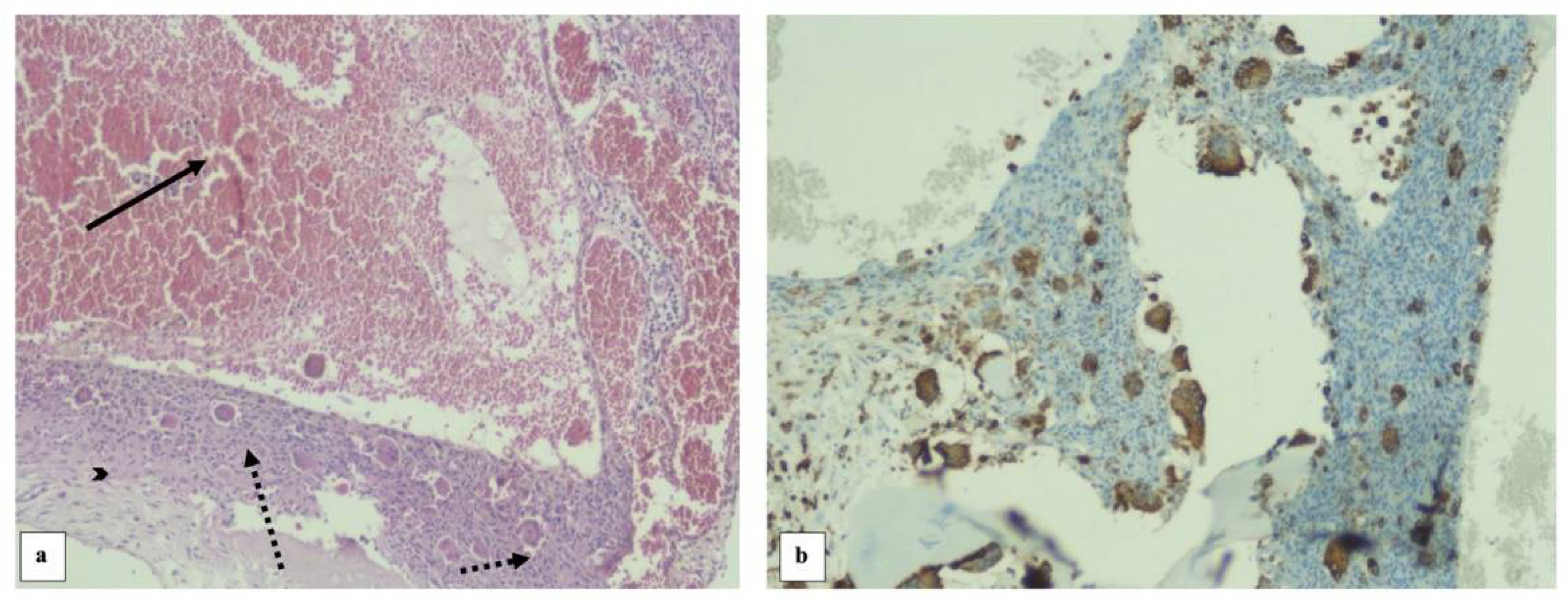 Diagnostics 13 00485 g008 Diagnostics 13 00485 g008