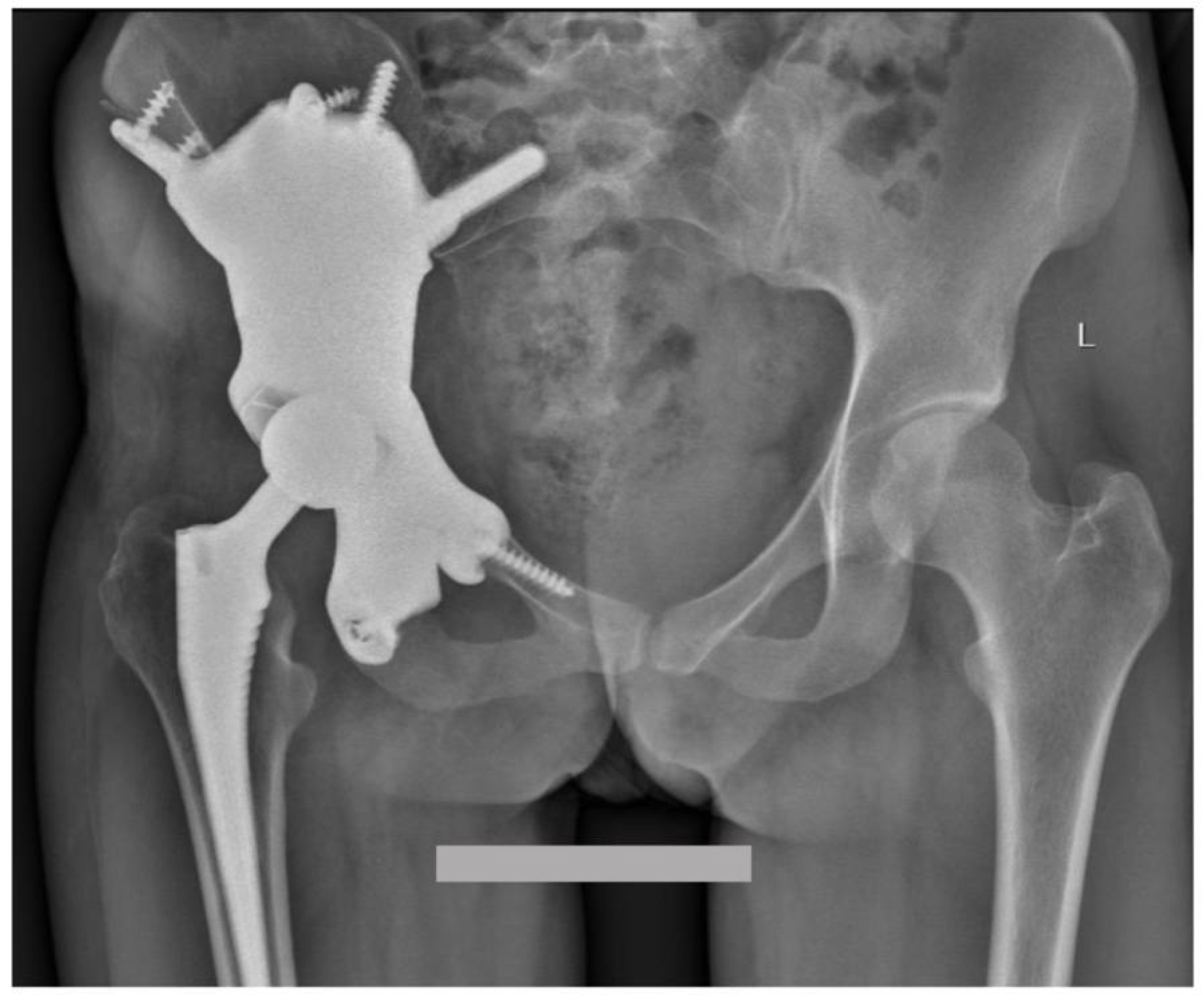 Diagnostics 13 00485 g009 Diagnostics 13 00485 g009