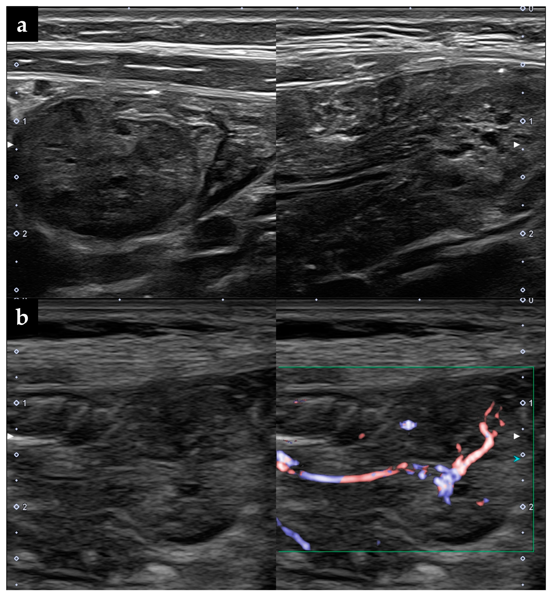 Diagnostics 13 00494 g001