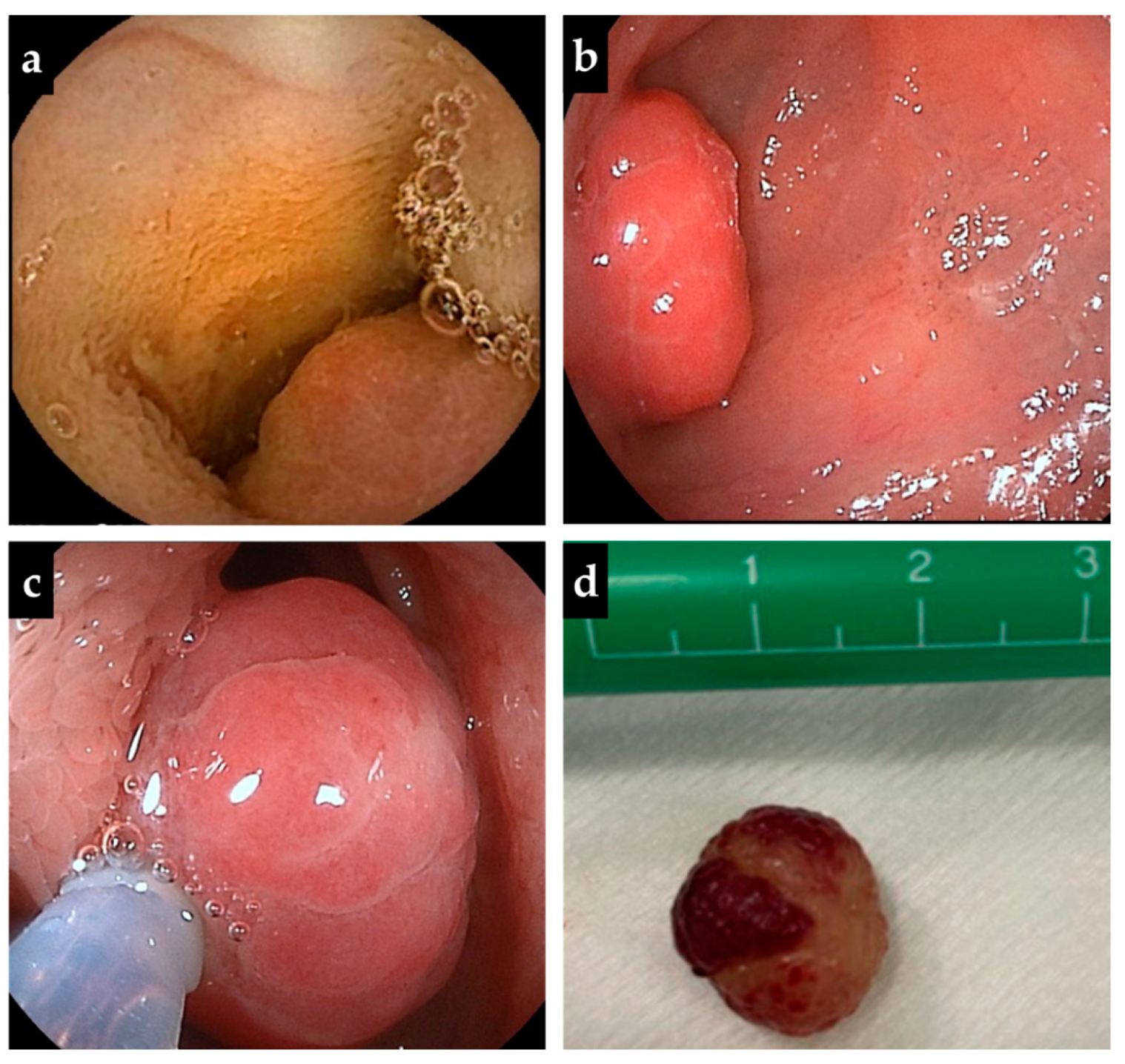 Diagnostics 13 00494 g002