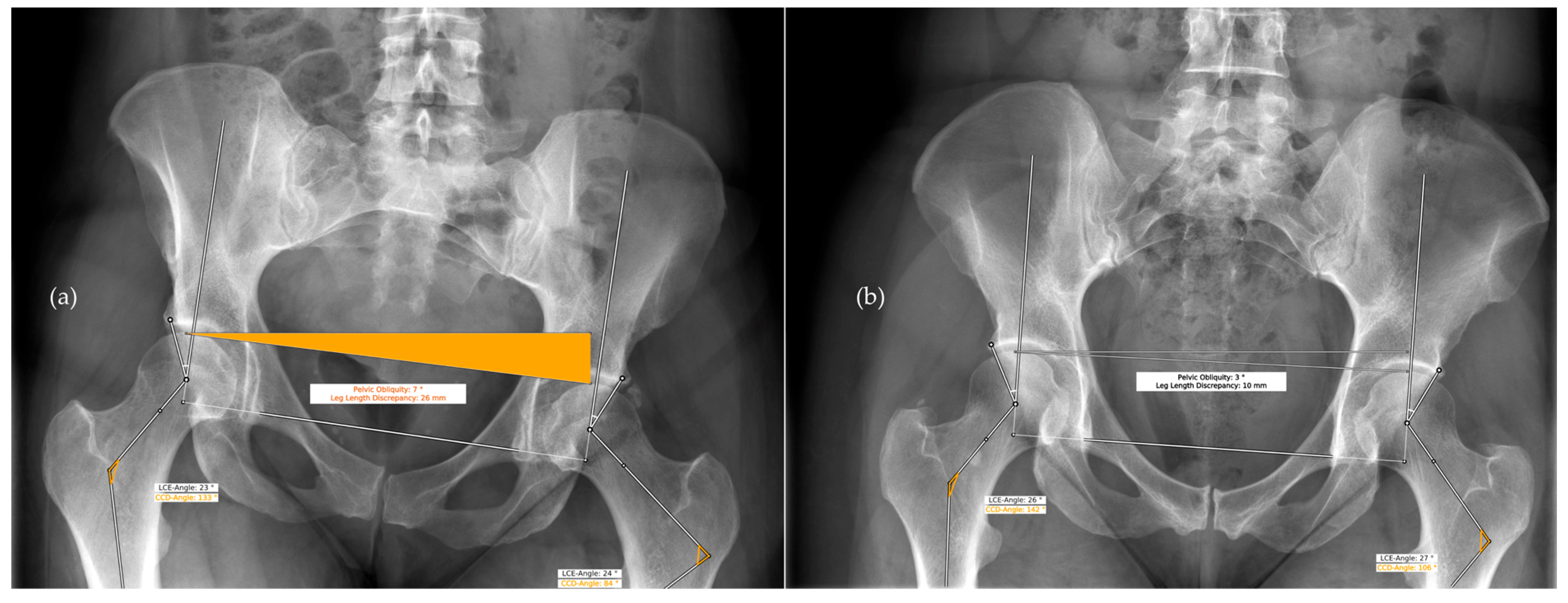 Diagnostics 13 00497 g004