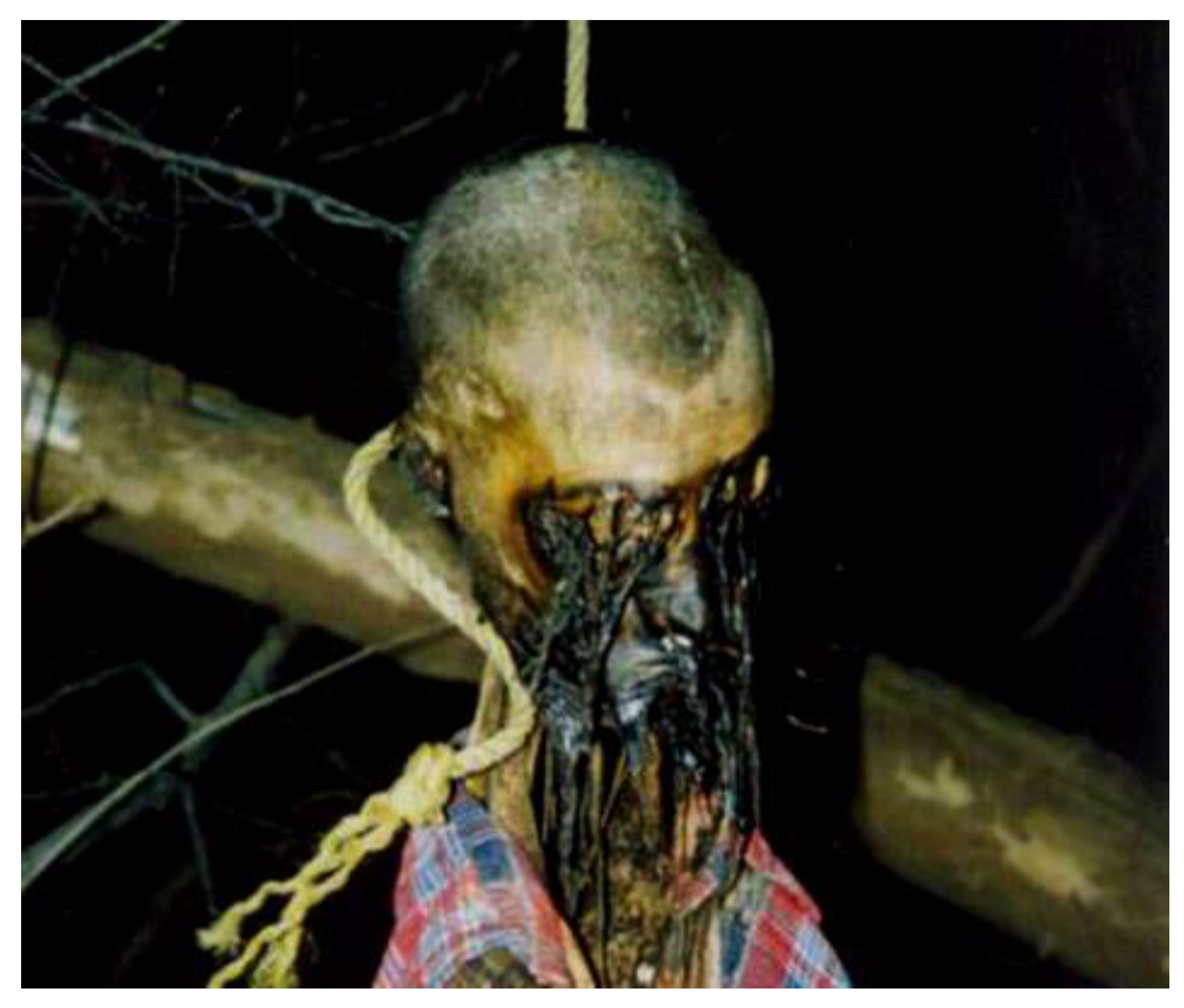 Diagnostics 13 00510 g001 Diagnostics 13 00510 g001