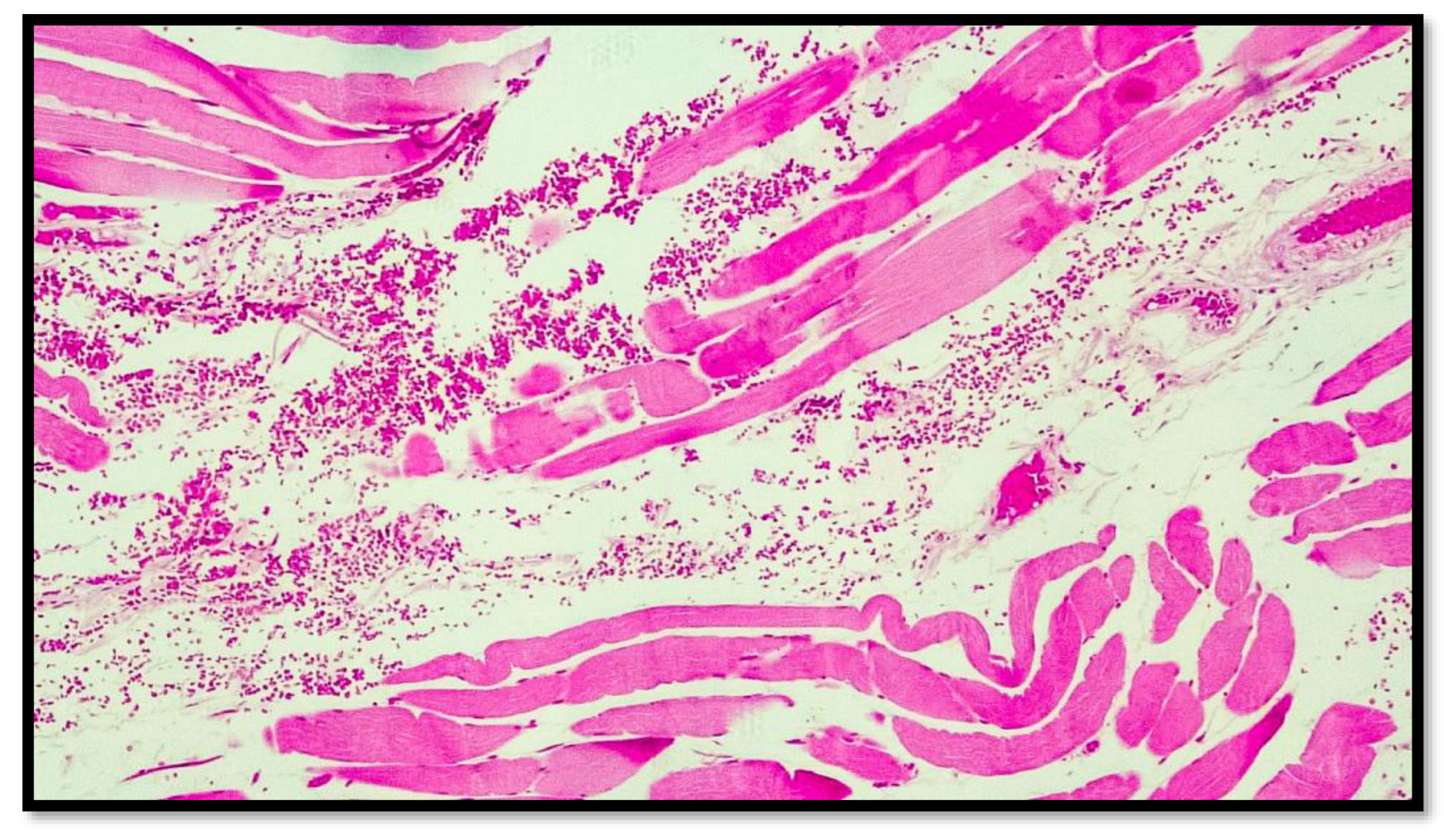 Diagnostics 13 00510 g003 Diagnostics 13 00510 g003