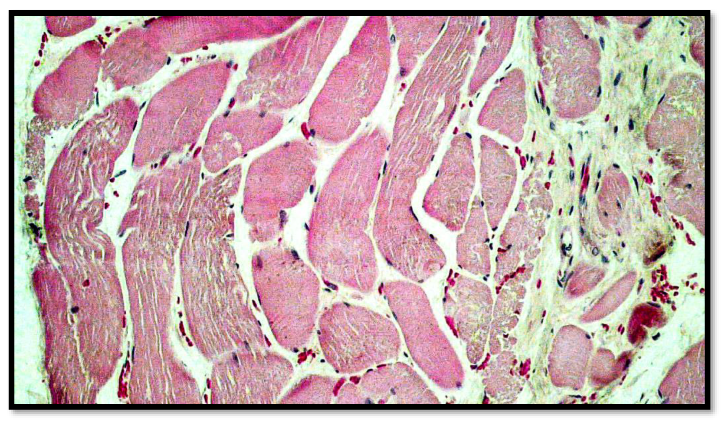 Diagnostics 13 00510 g006 Diagnostics 13 00510 g006