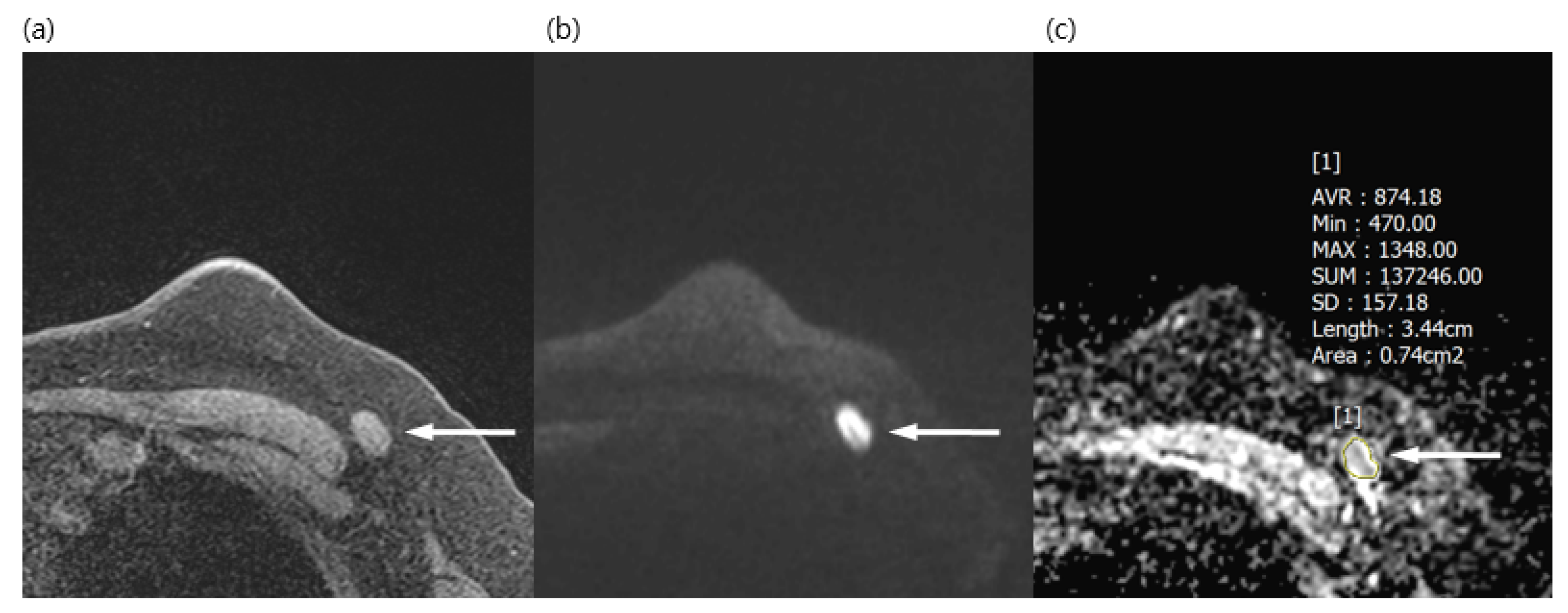 Diagnostics 13 00513 g001