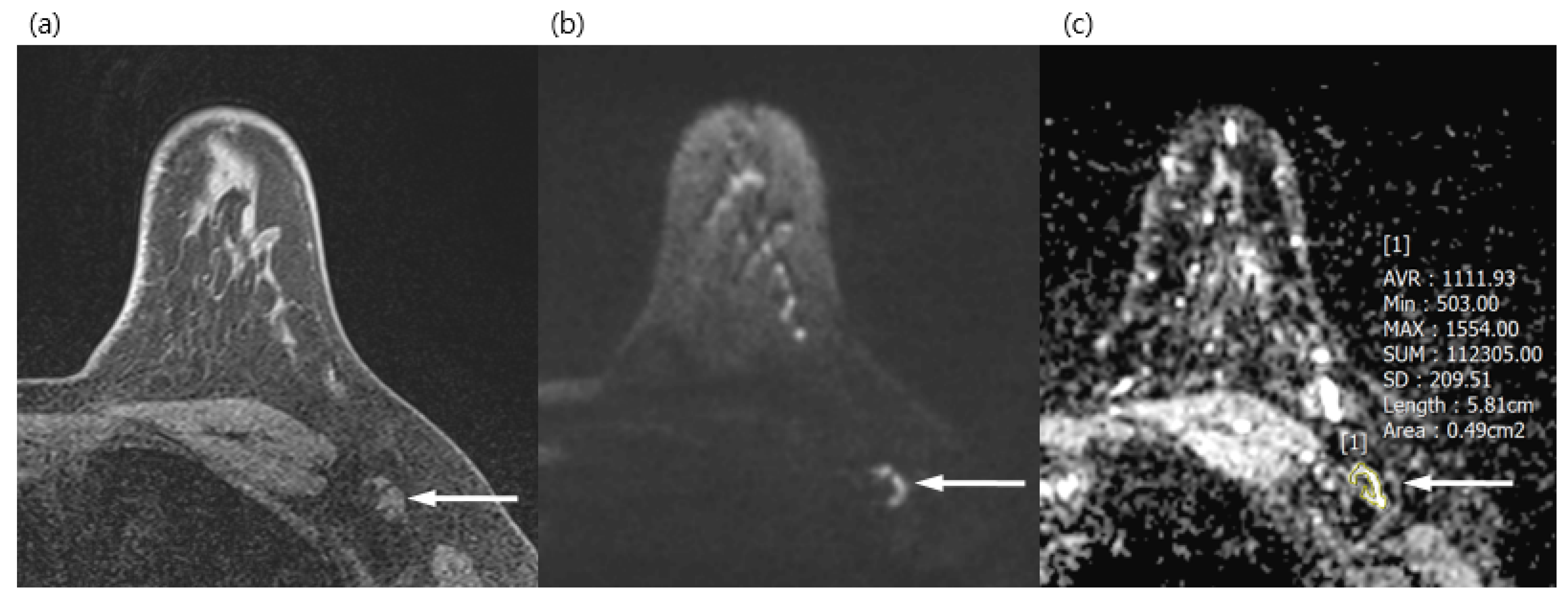 Diagnostics 13 00513 g002