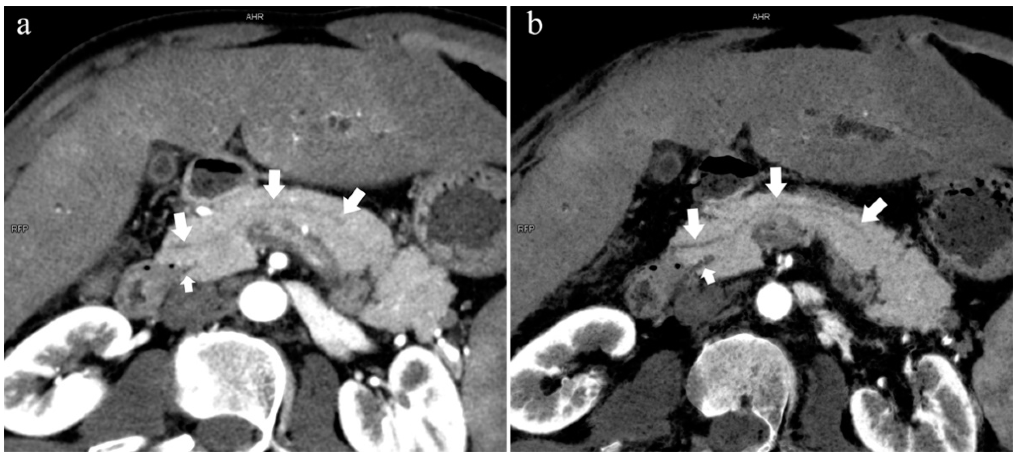 Diagnostics 13 00520 g006