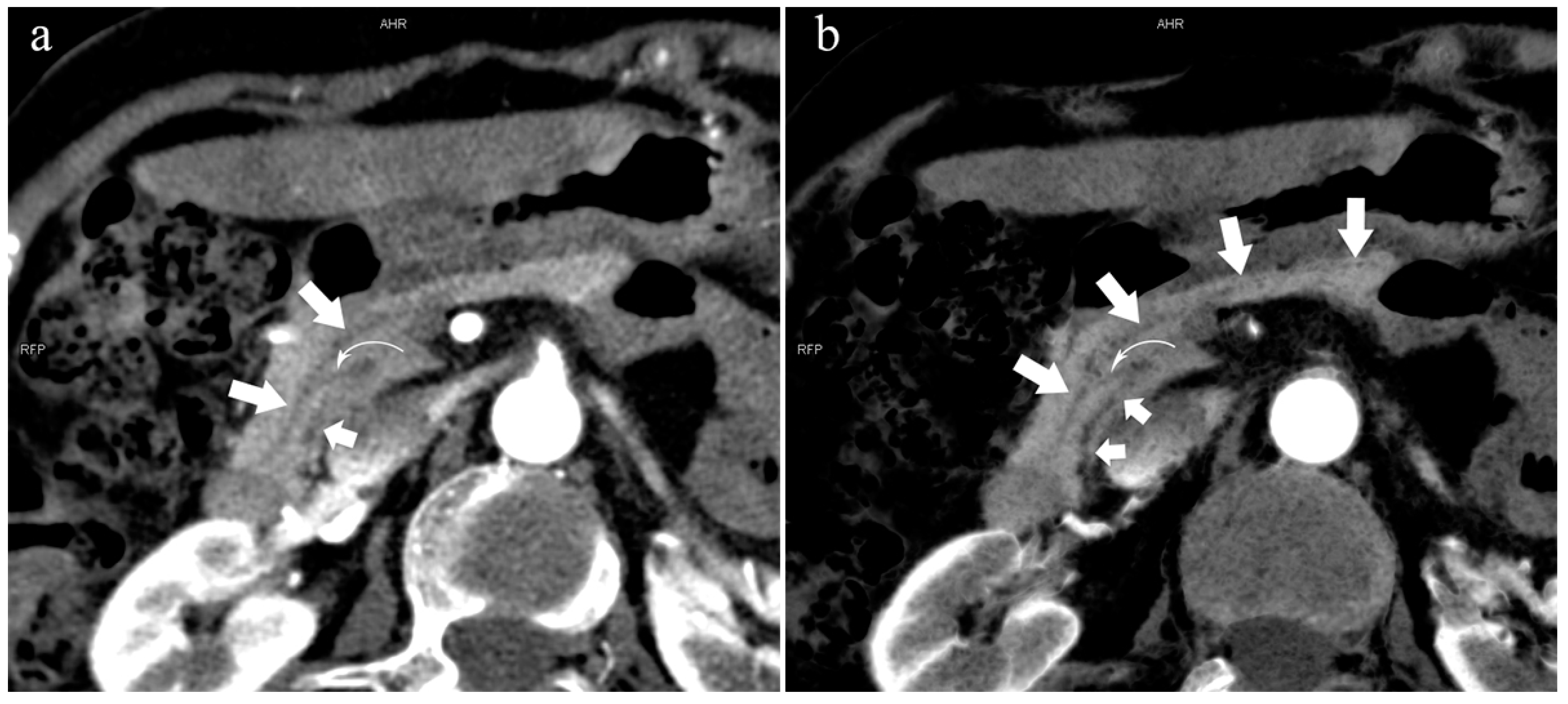 Diagnostics 13 00520 g008