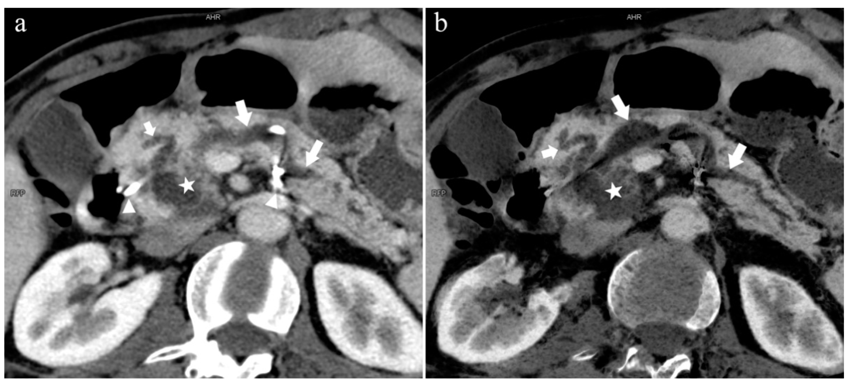 Diagnostics 13 00520 g009
