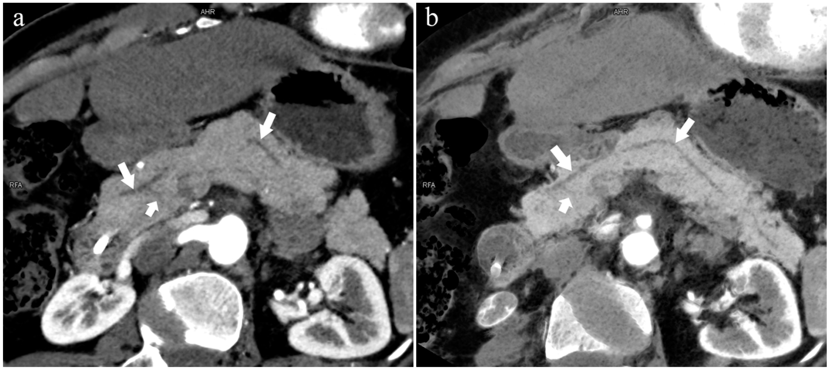 Diagnostics 13 00520 g010