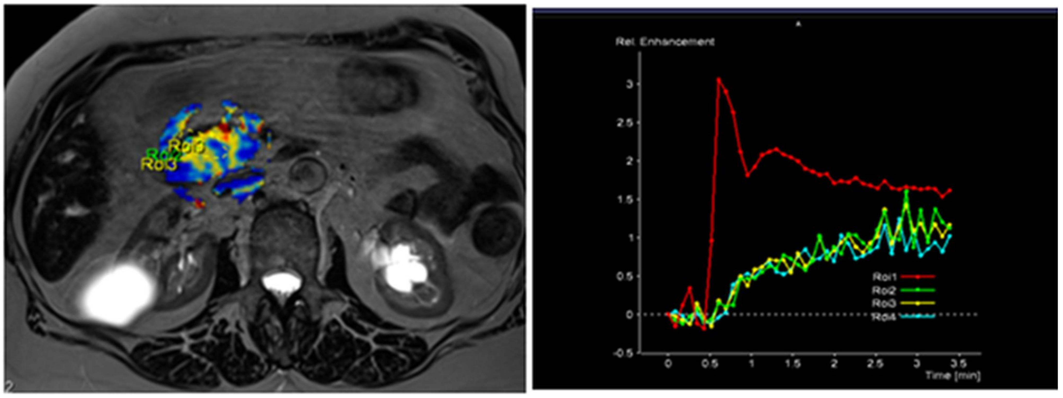 Diagnostics 13 00521 g003
