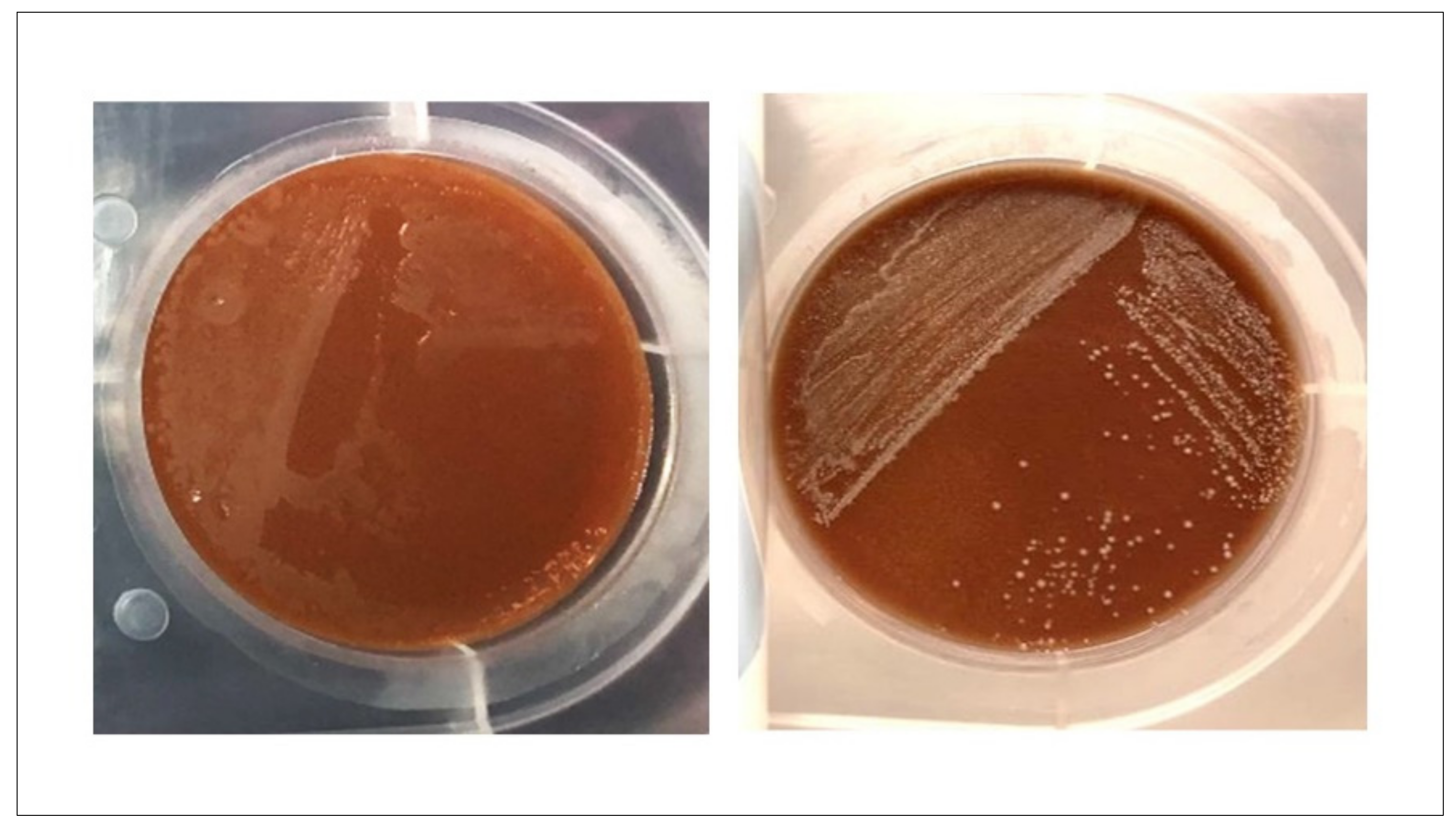 Diagnostics 13 00523 g0a2