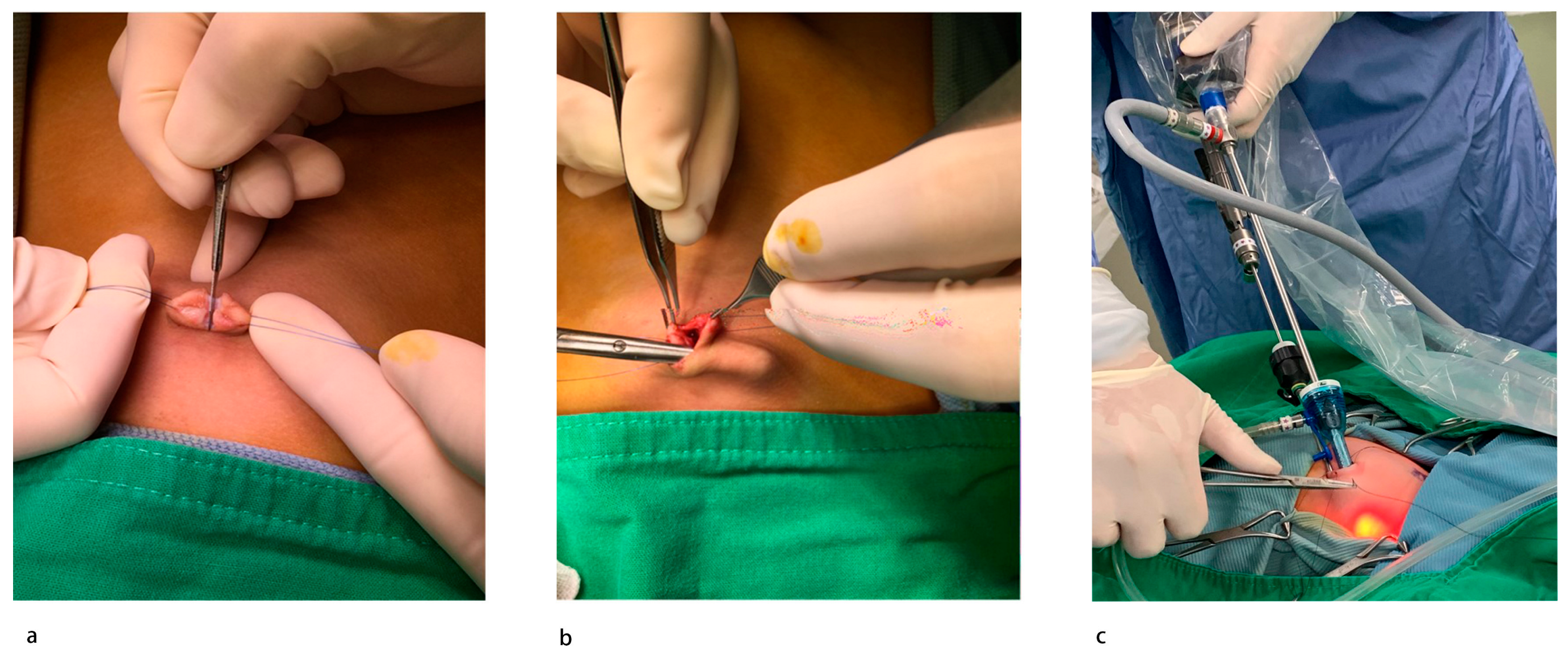 Diagnostics 13 00529 g001