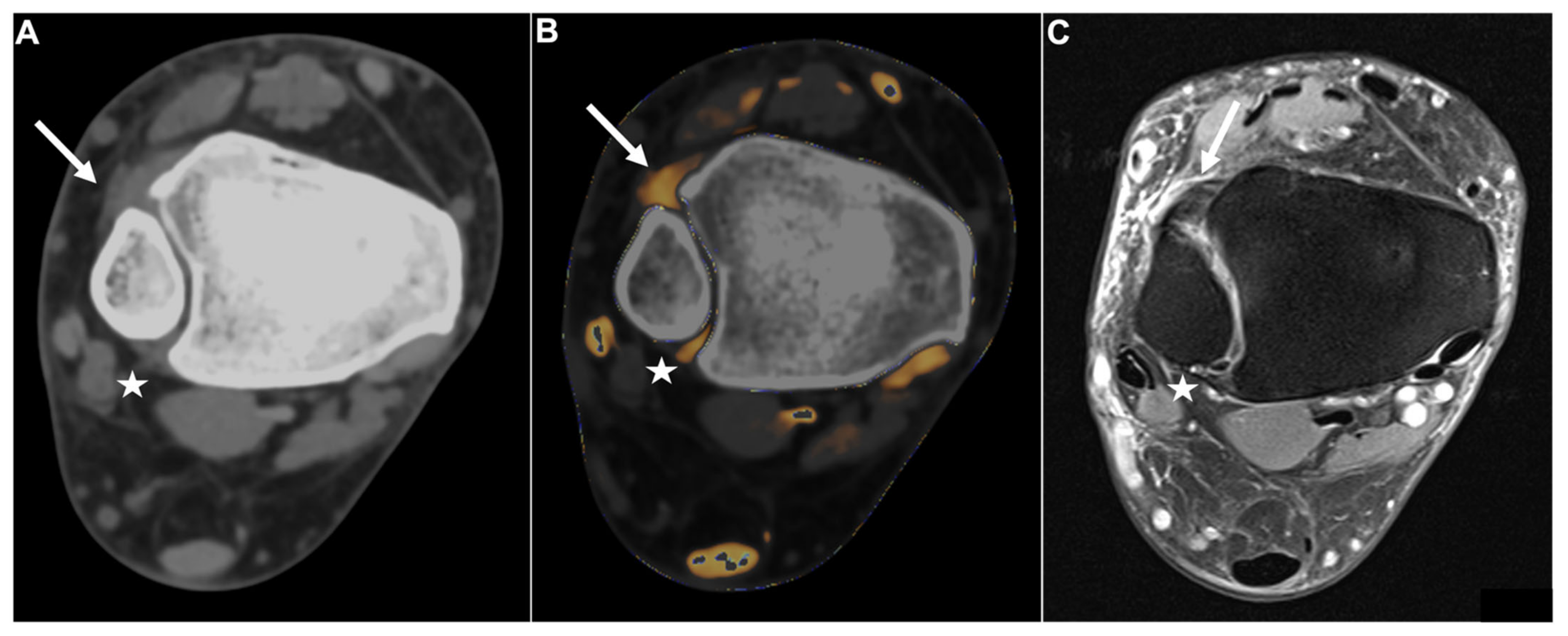 Diagnostics 13 00533 g002
