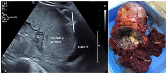 Diagnostics 13 00539 g001 550