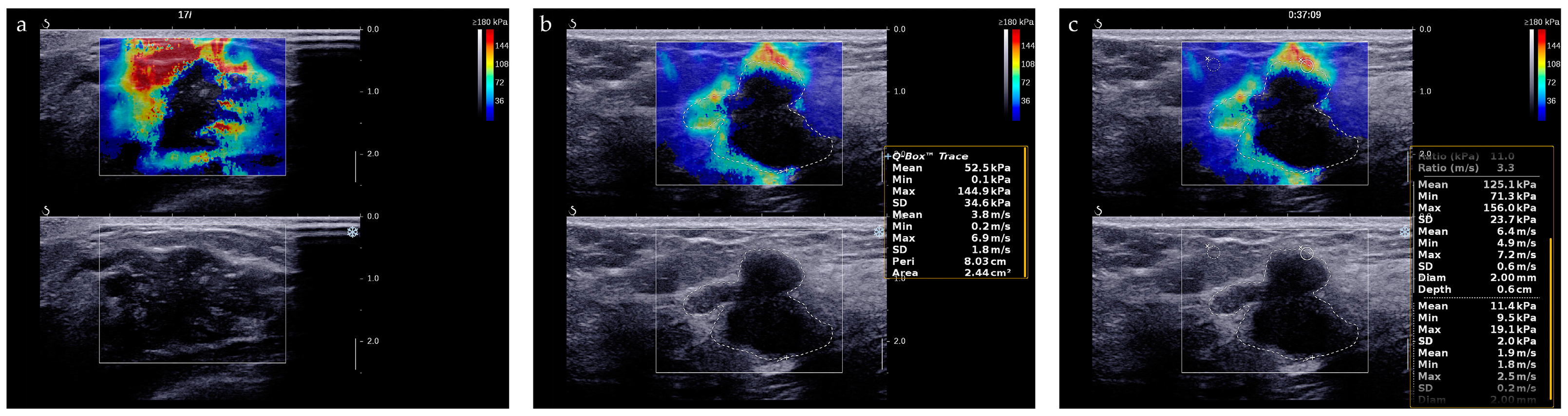 Diagnostics 13 00540 g004