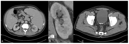 Diagnostics 13 00542 g001