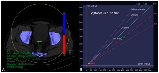 Diagnostics 13 00542 g002