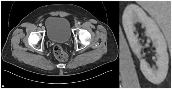 Diagnostics 13 00542 g003