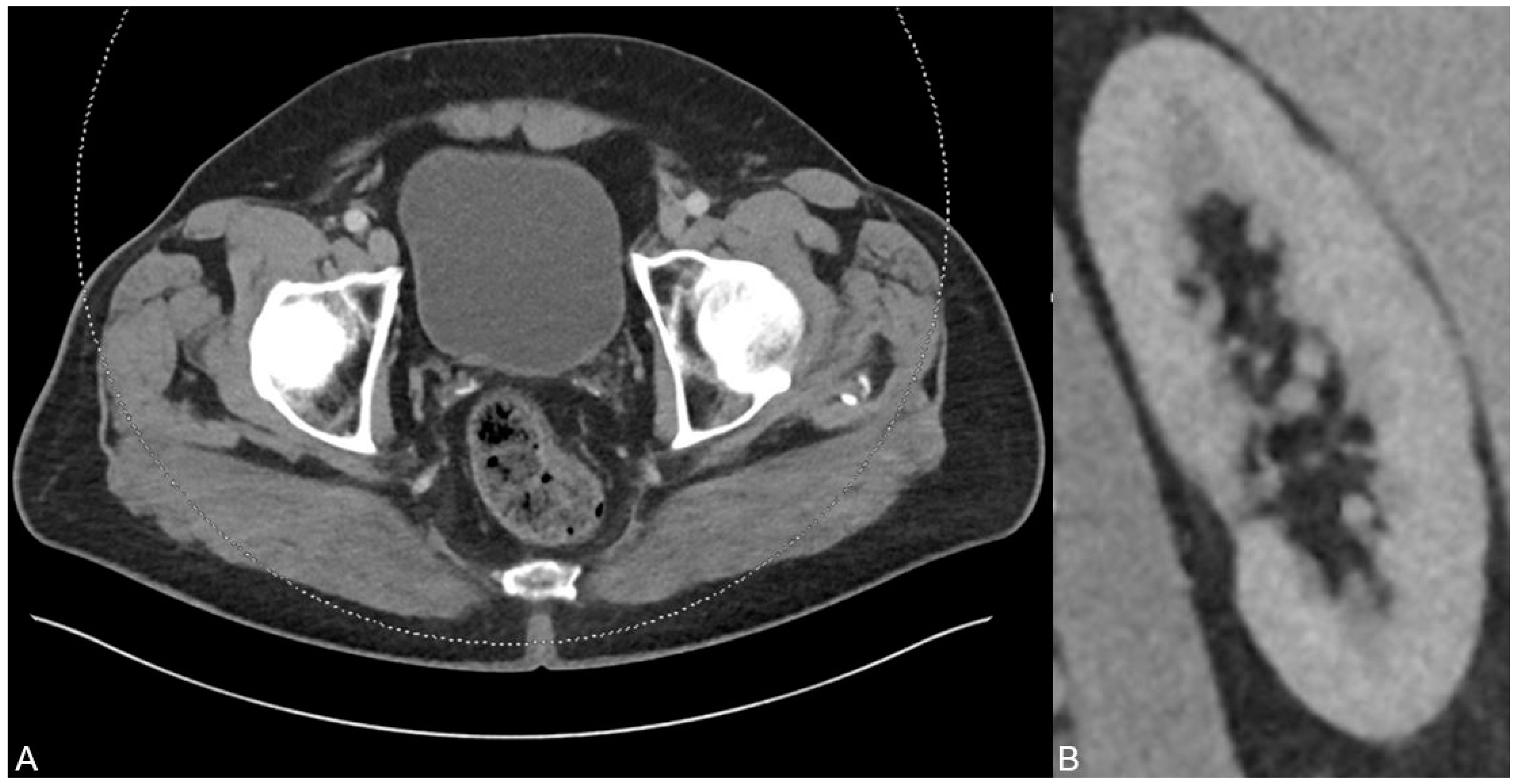 Diagnostics 13 00542 g003