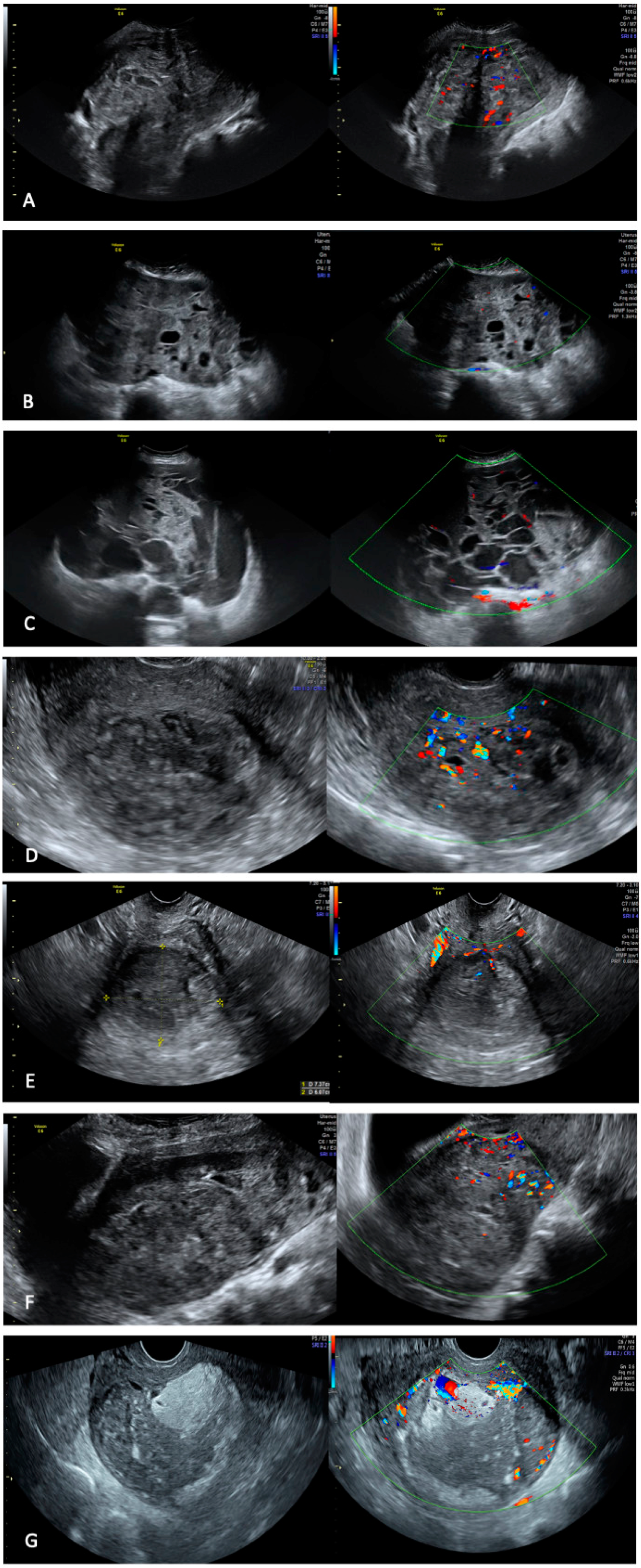 Diagnostics 13 00543 g001