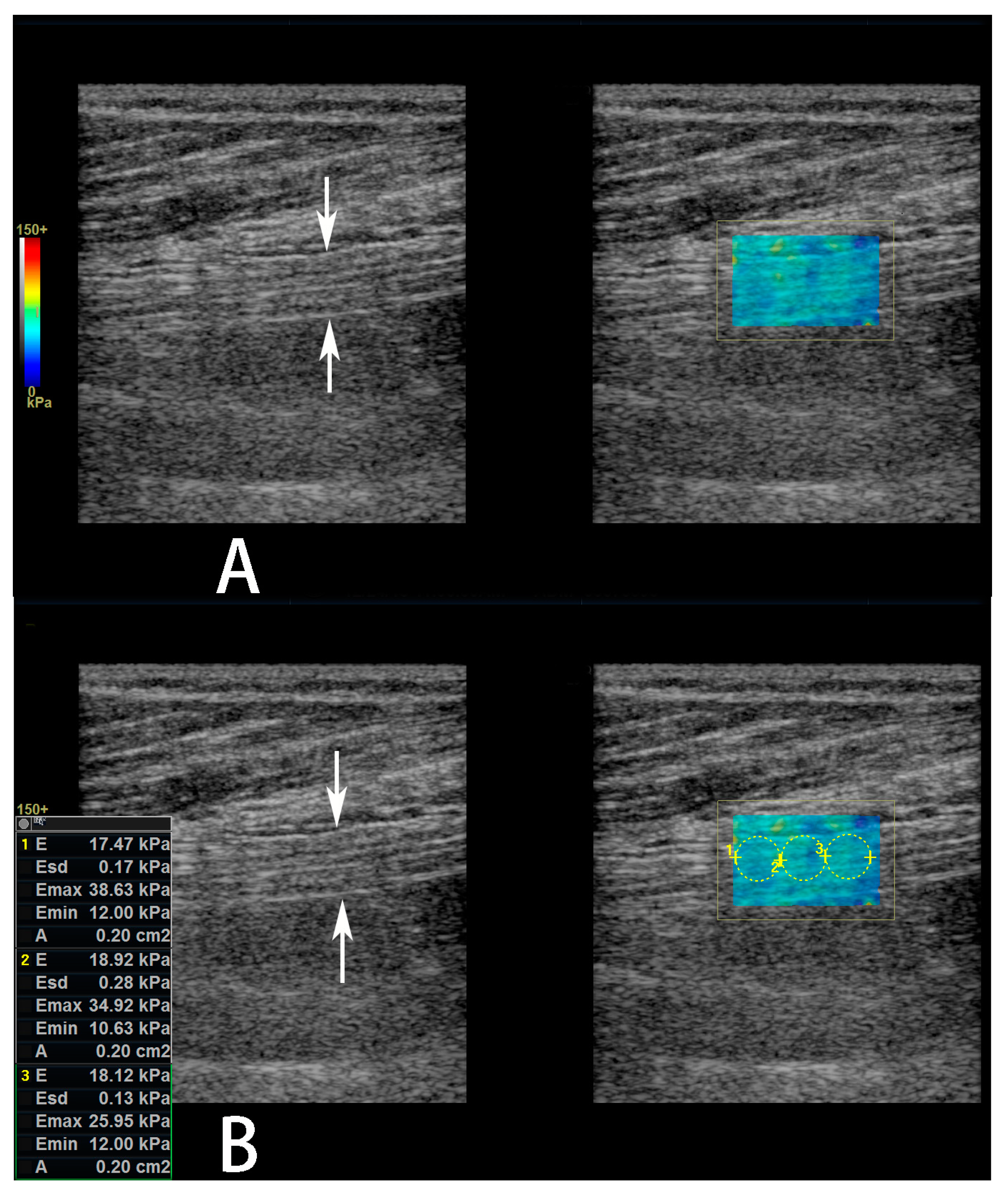 Diagnostics 13 00547 g002