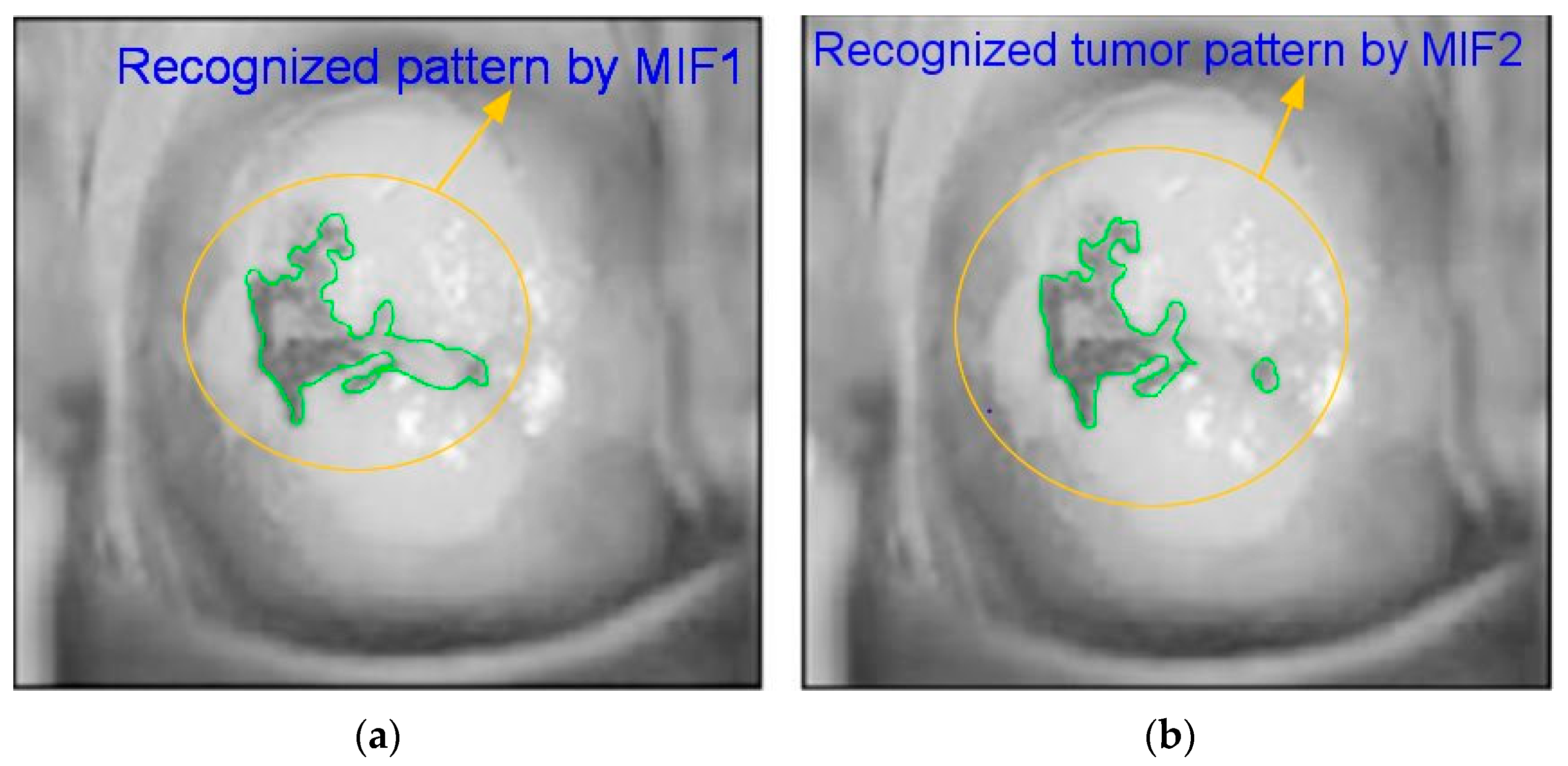 Diagnostics 13 00548 g006