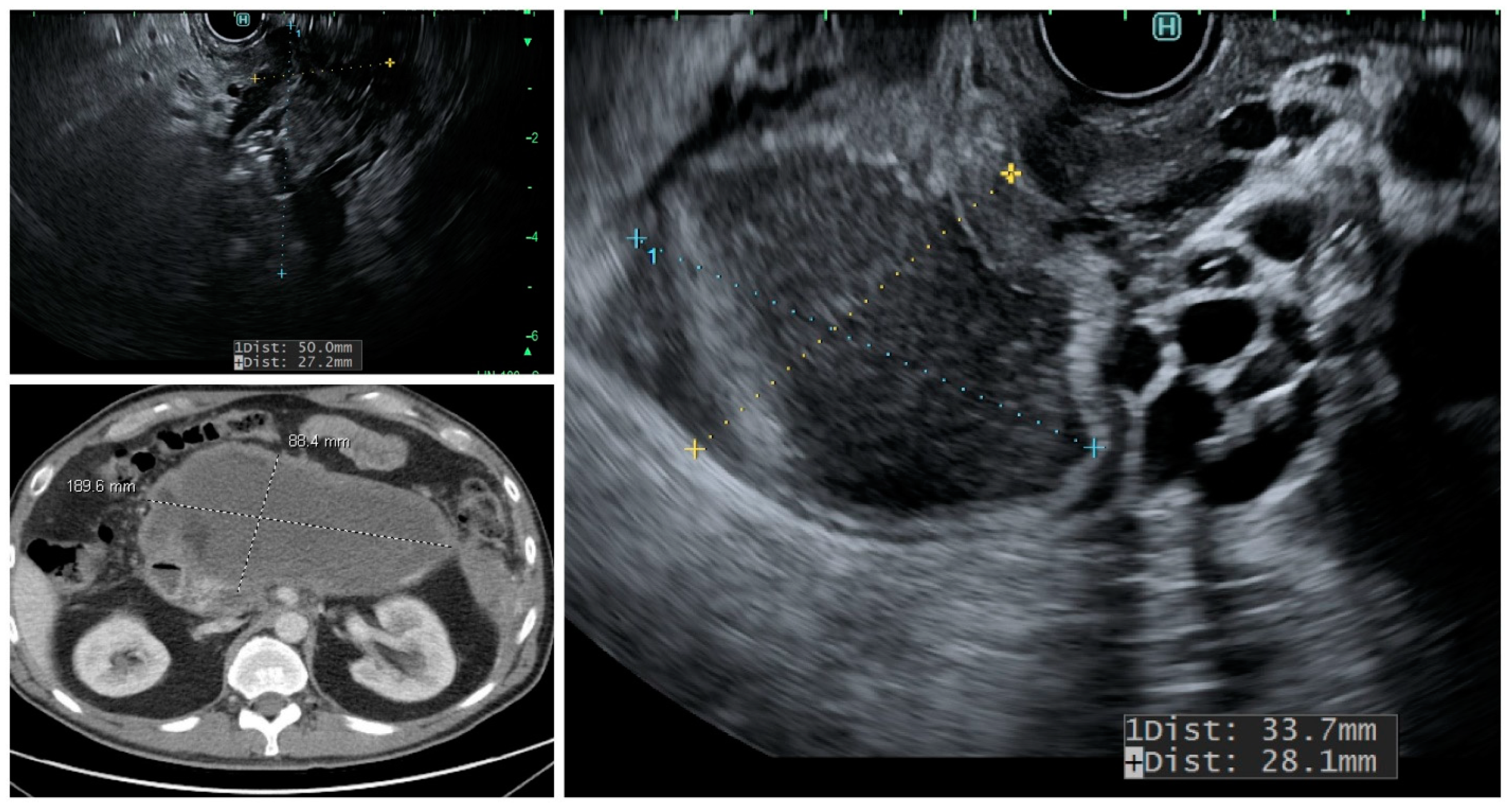 Diagnostics 13 00550 g001