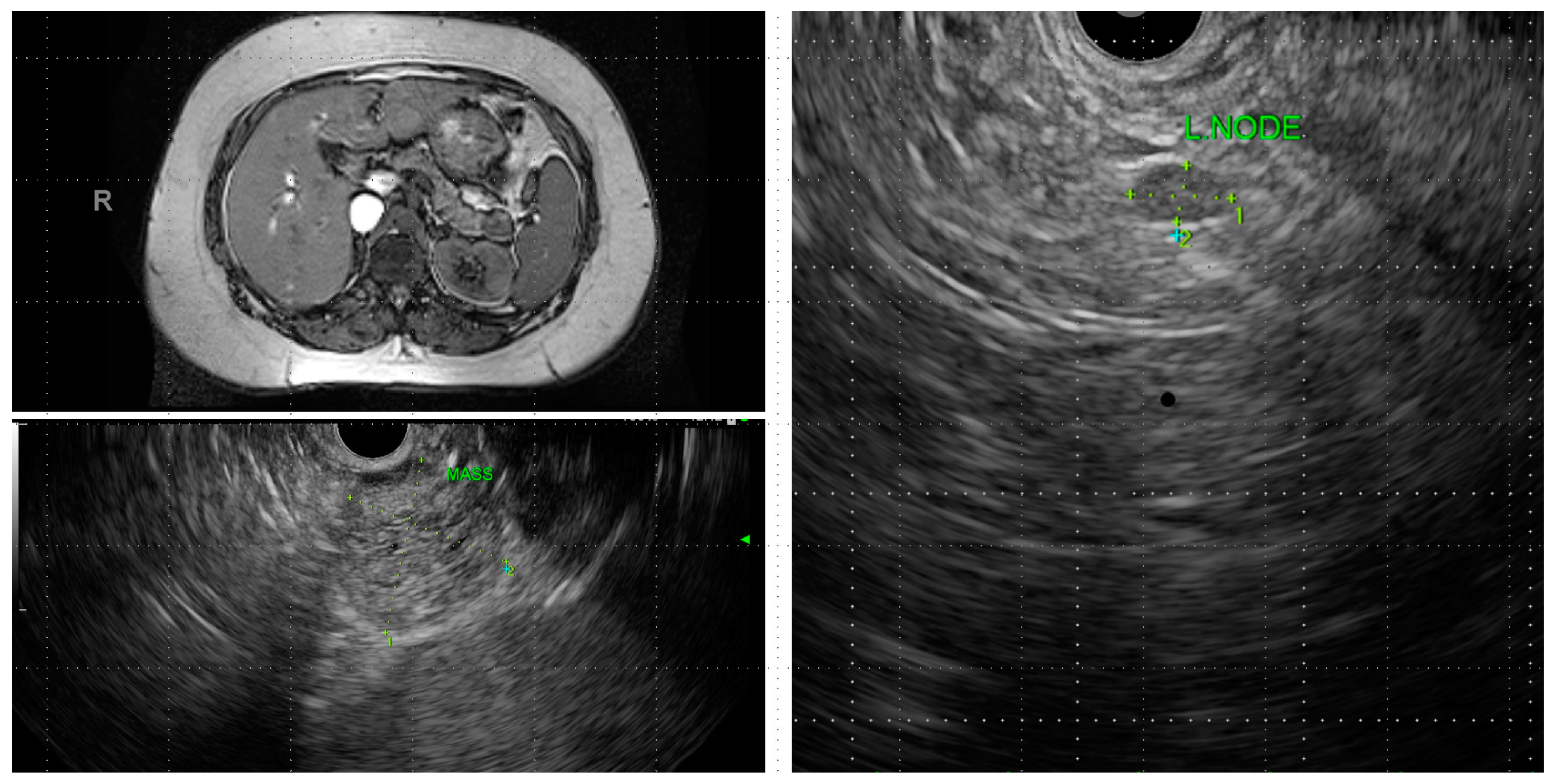 Diagnostics 13 00550 g004