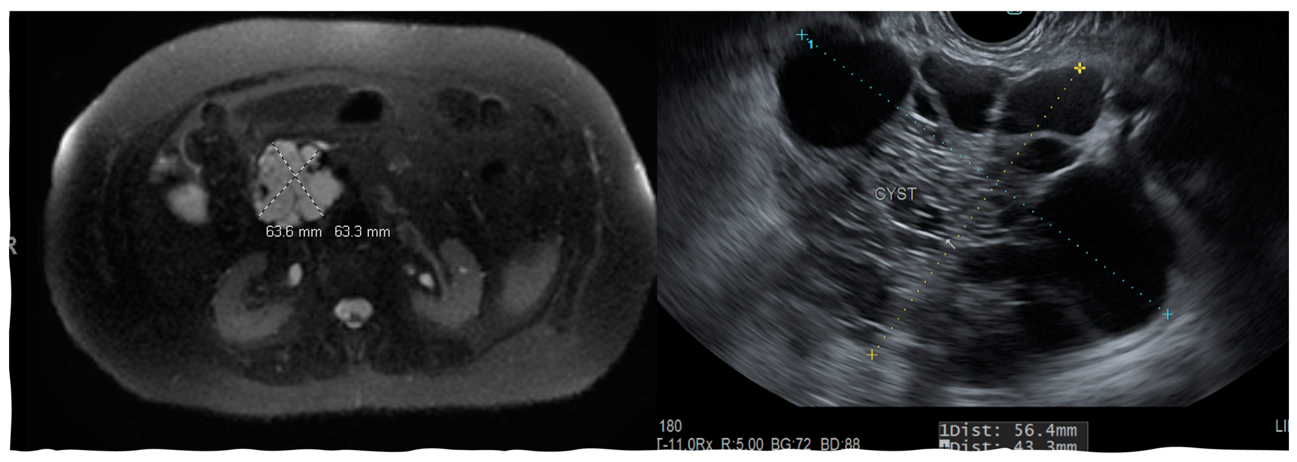 Diagnostics 13 00550 g005
