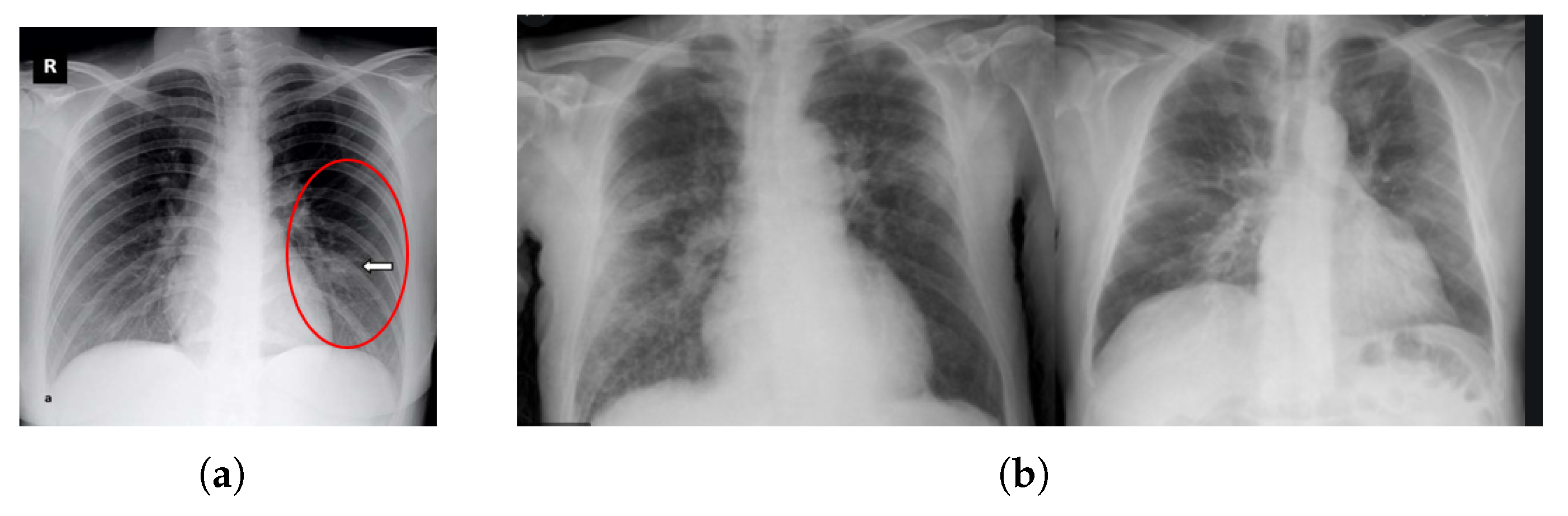 Diagnostics 13 00551 g002