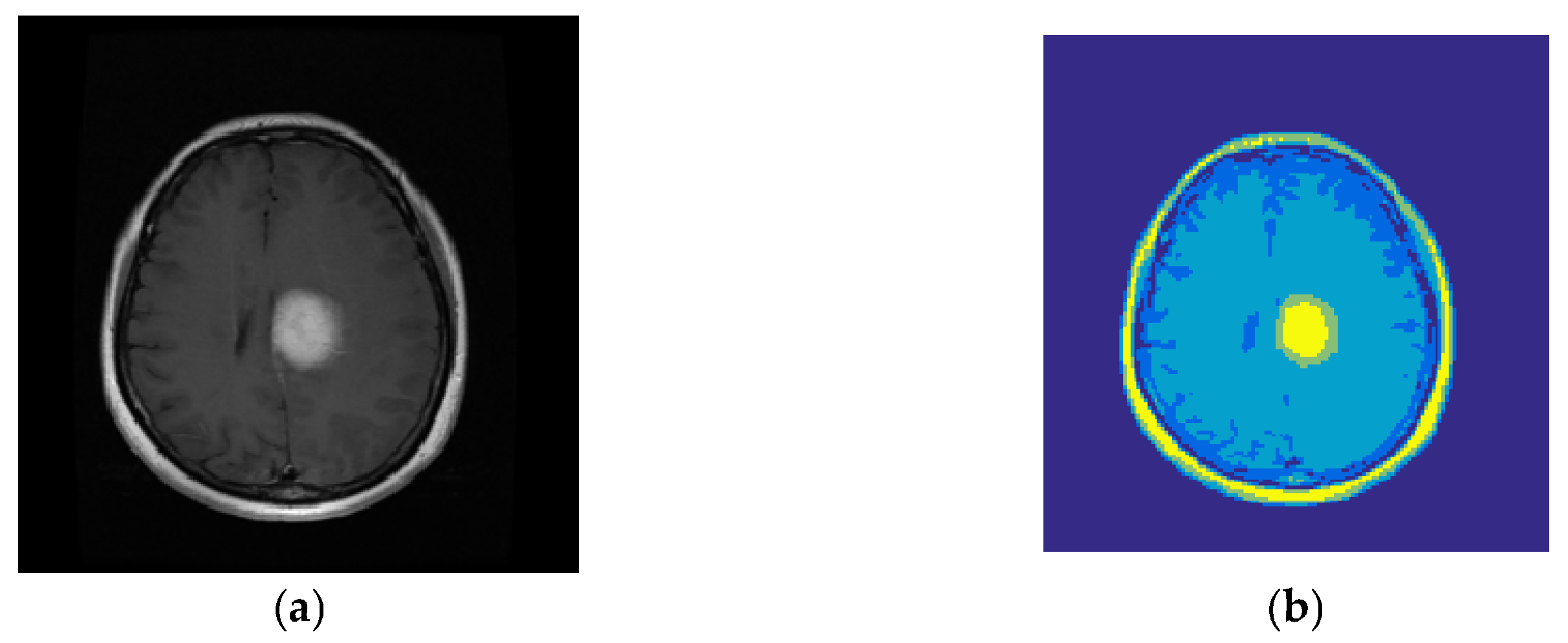 Diagnostics 13 00561 g003