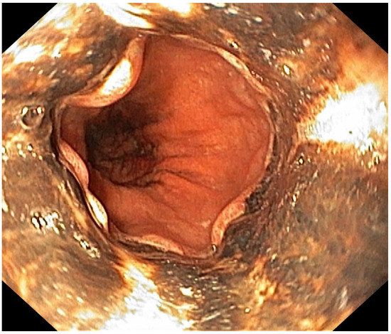 Diagnostics 13 00562 g002 550