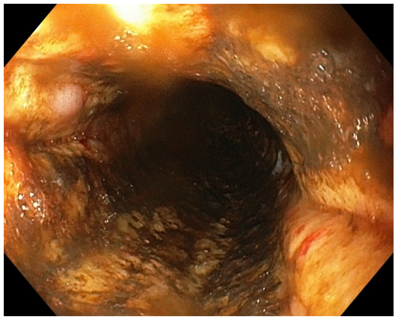 Diagnostics 13 00562 g003