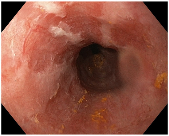 Diagnostics 13 00562 g005 550