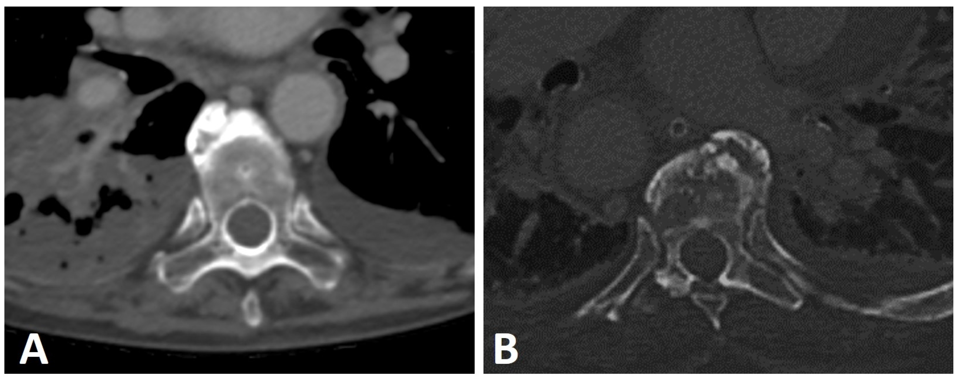 Diagnostics 13 00563 g005
