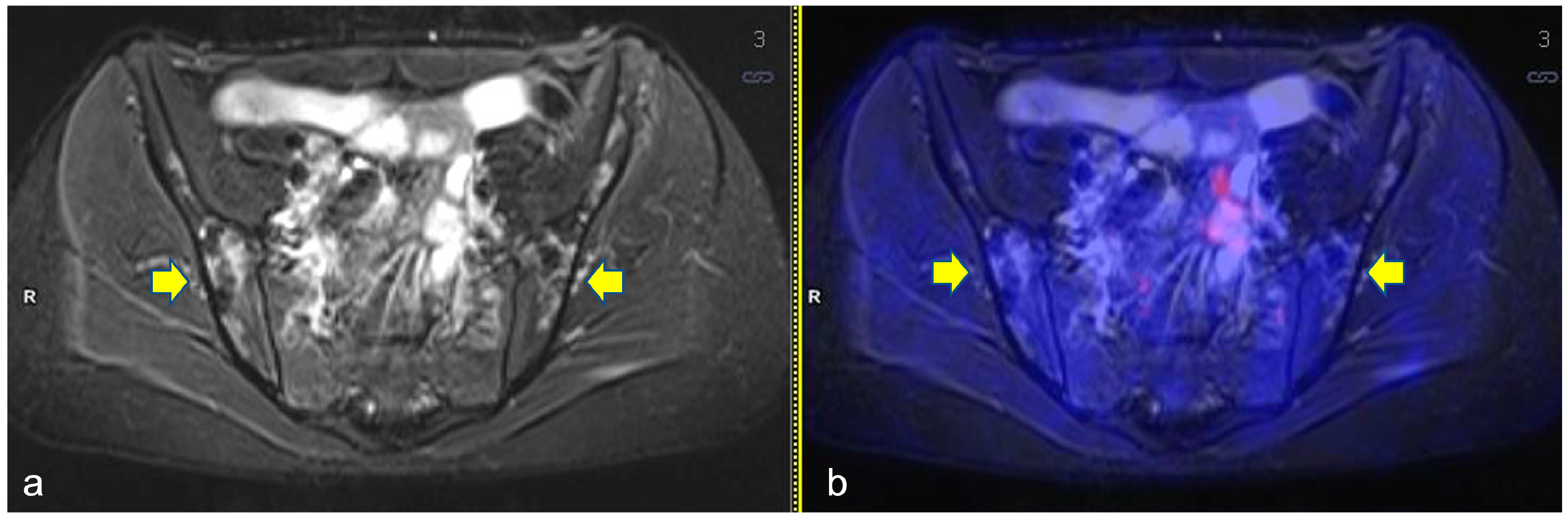 Diagnostics 13 00565 g001