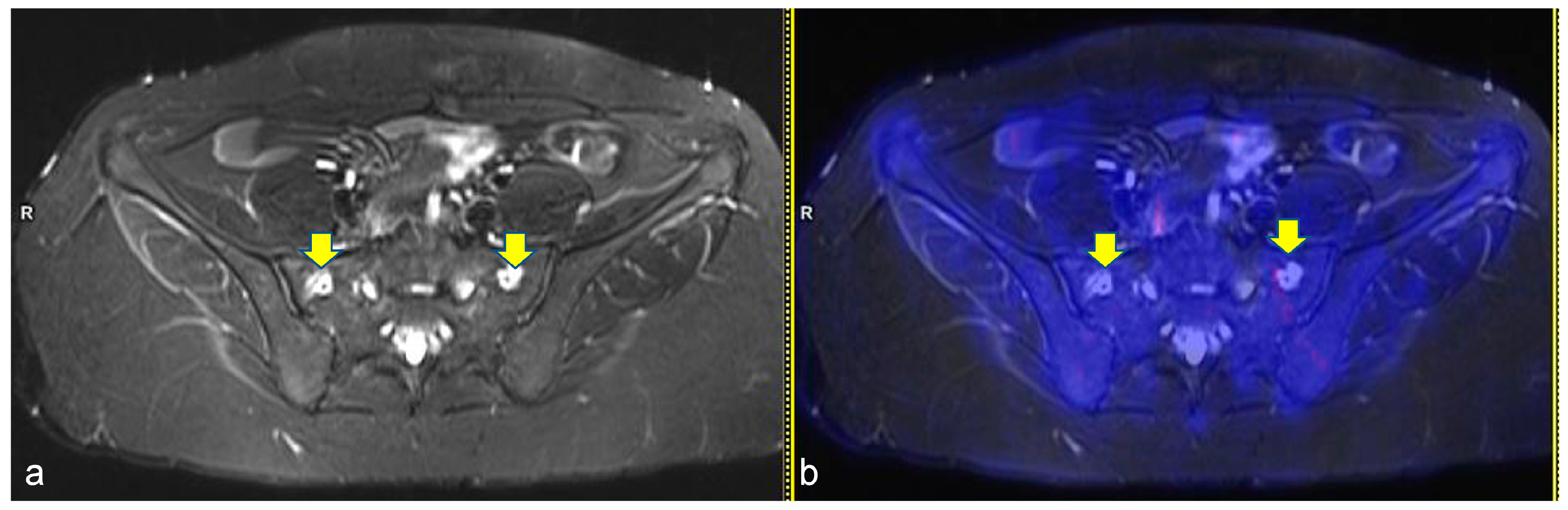Diagnostics 13 00565 g003